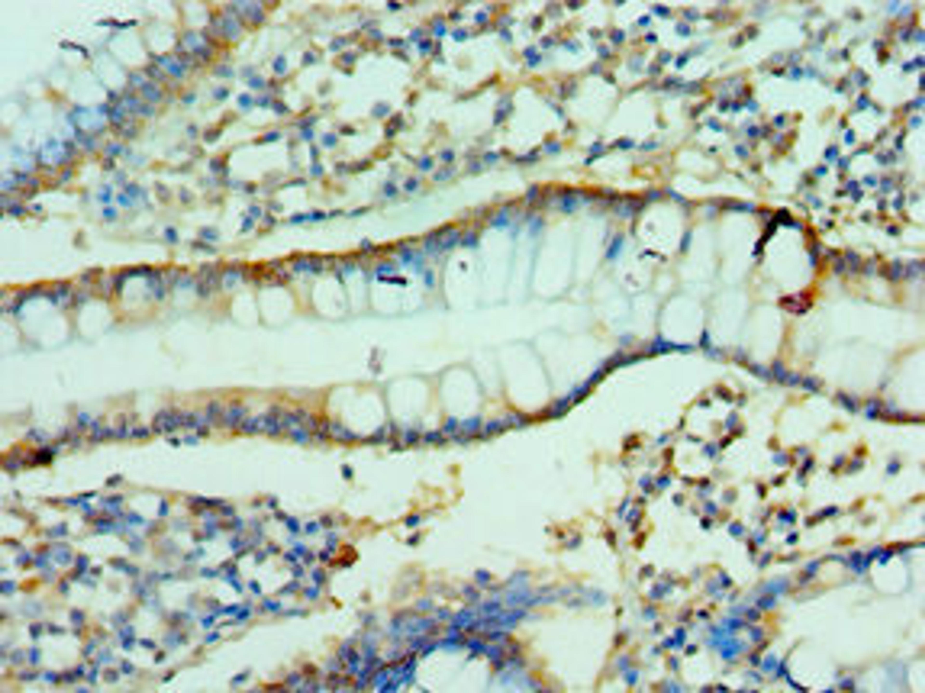 Immunohistochemistry of paraffin-embedded human small intestine tissue using CSB-PA005500ESR2HU at dilution of 1:100