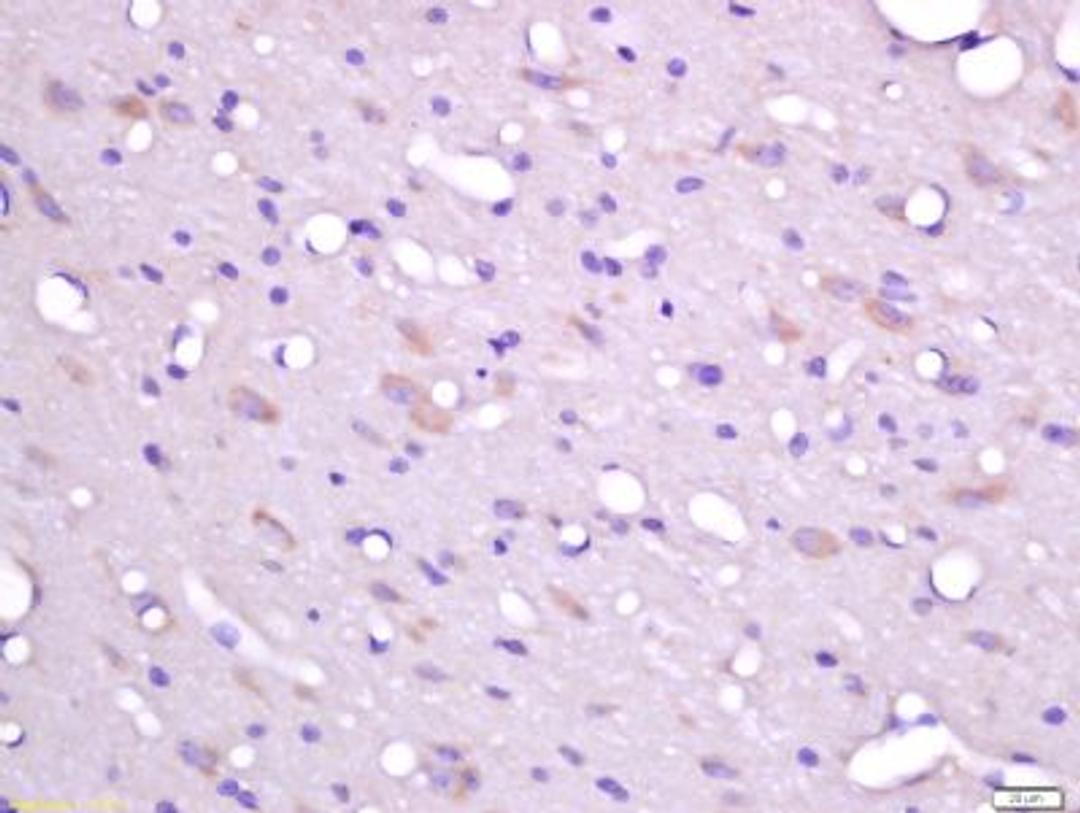 Immunohistochemical staining of rat brain tissue using FHOD3 antibody.