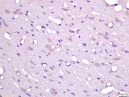 Immunohistochemical staining of rat brain tissue using FHOD3 antibody.