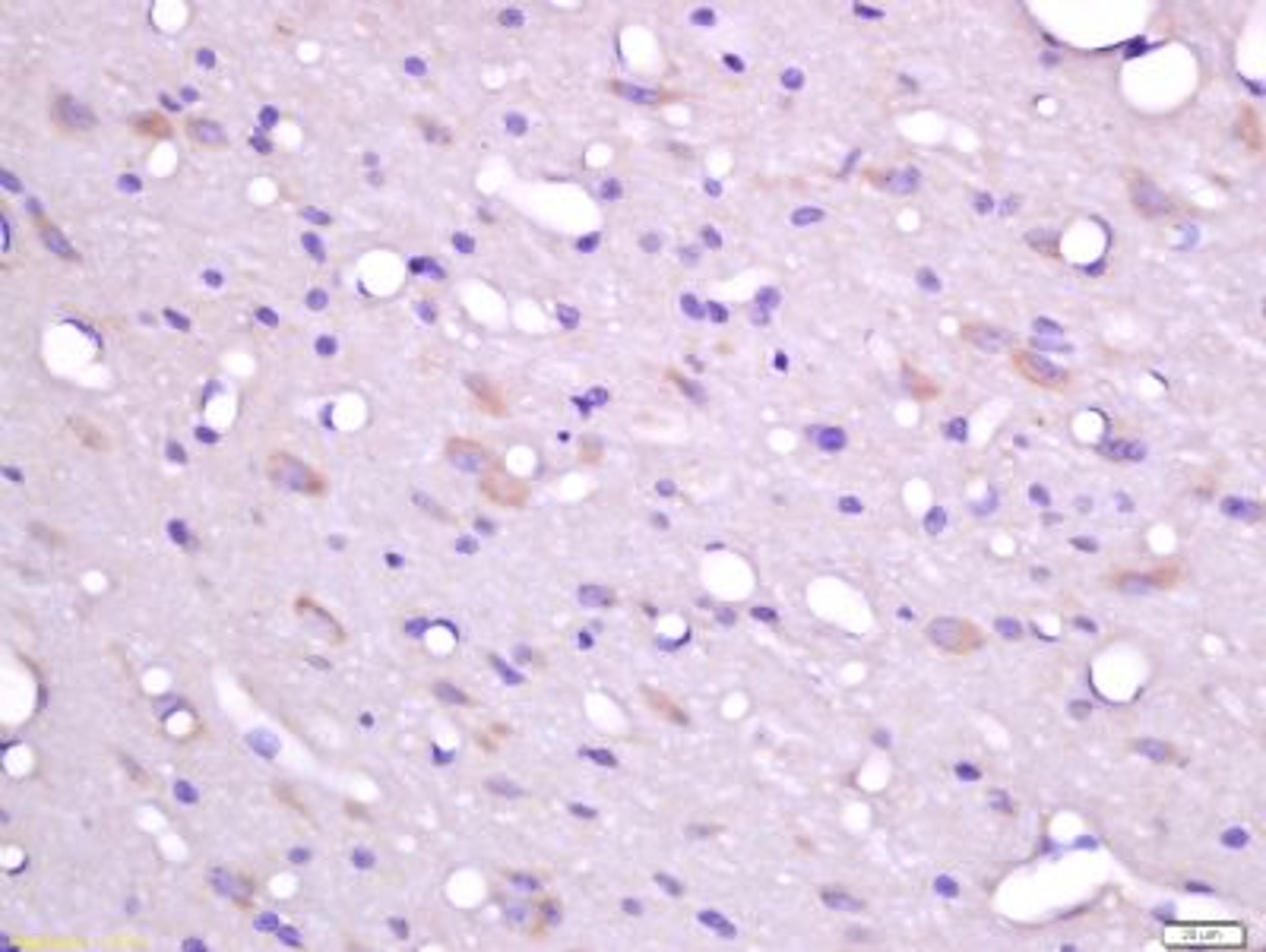 Immunohistochemical staining of rat brain tissue using FHOD3 antibody.