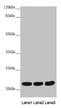 Western blot. All lanes: MYL3 antibody at 3.78 ug/ml. Lane 1: Mouse heart tissue. Lane 2: Mouse skeletal muscle tissue. Lane 3: Rat heart tissue. Secondary. Goat polyclonal to rabbit IgG at 1/10000 dilution. Predicted band size: 22 kDa. Observed band size: 22 kDa. 