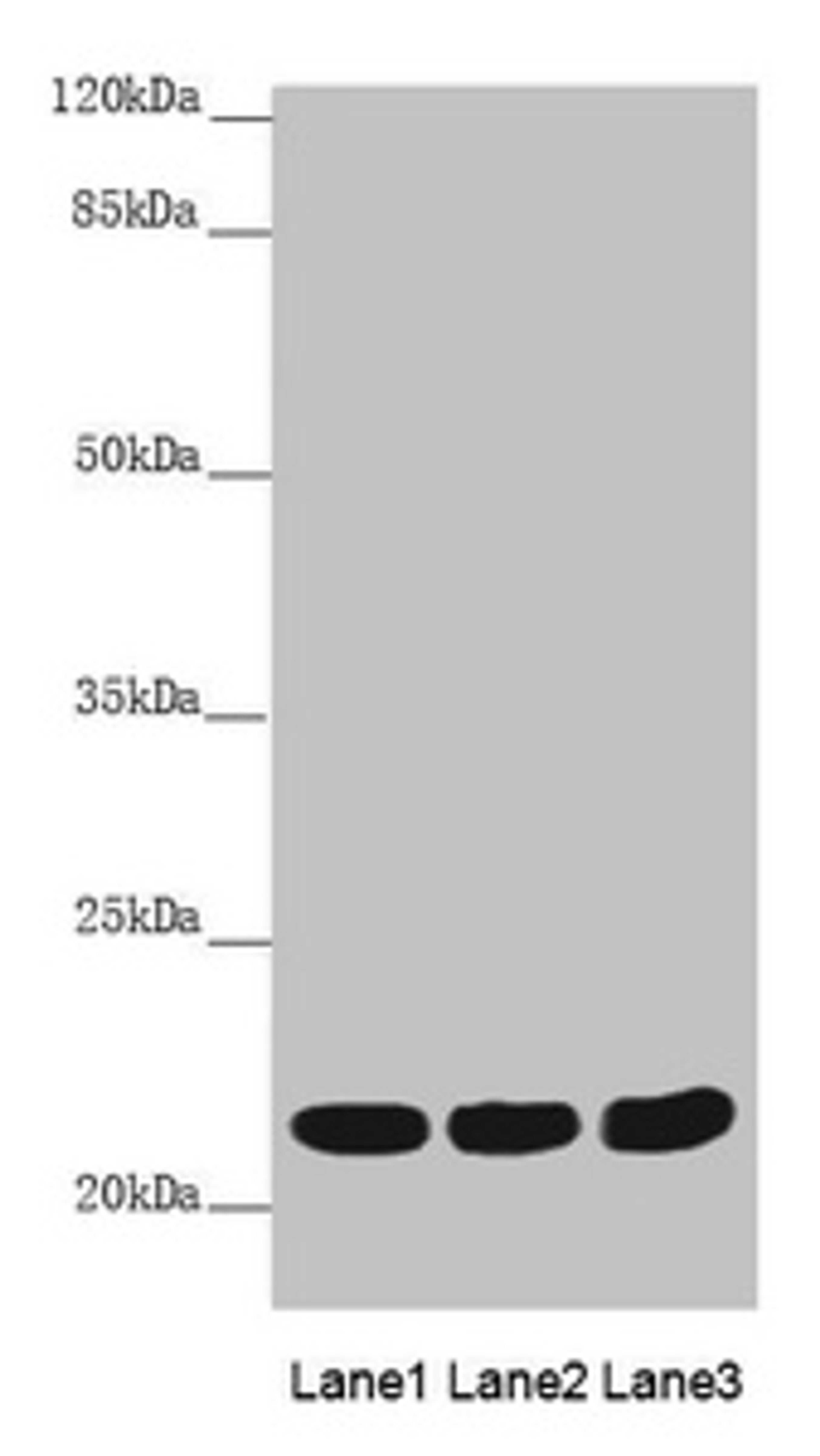 Western blot. All lanes: MYL3 antibody at 3.78 ug/ml. Lane 1: Mouse heart tissue. Lane 2: Mouse skeletal muscle tissue. Lane 3: Rat heart tissue. Secondary. Goat polyclonal to rabbit IgG at 1/10000 dilution. Predicted band size: 22 kDa. Observed band size: 22 kDa. 
