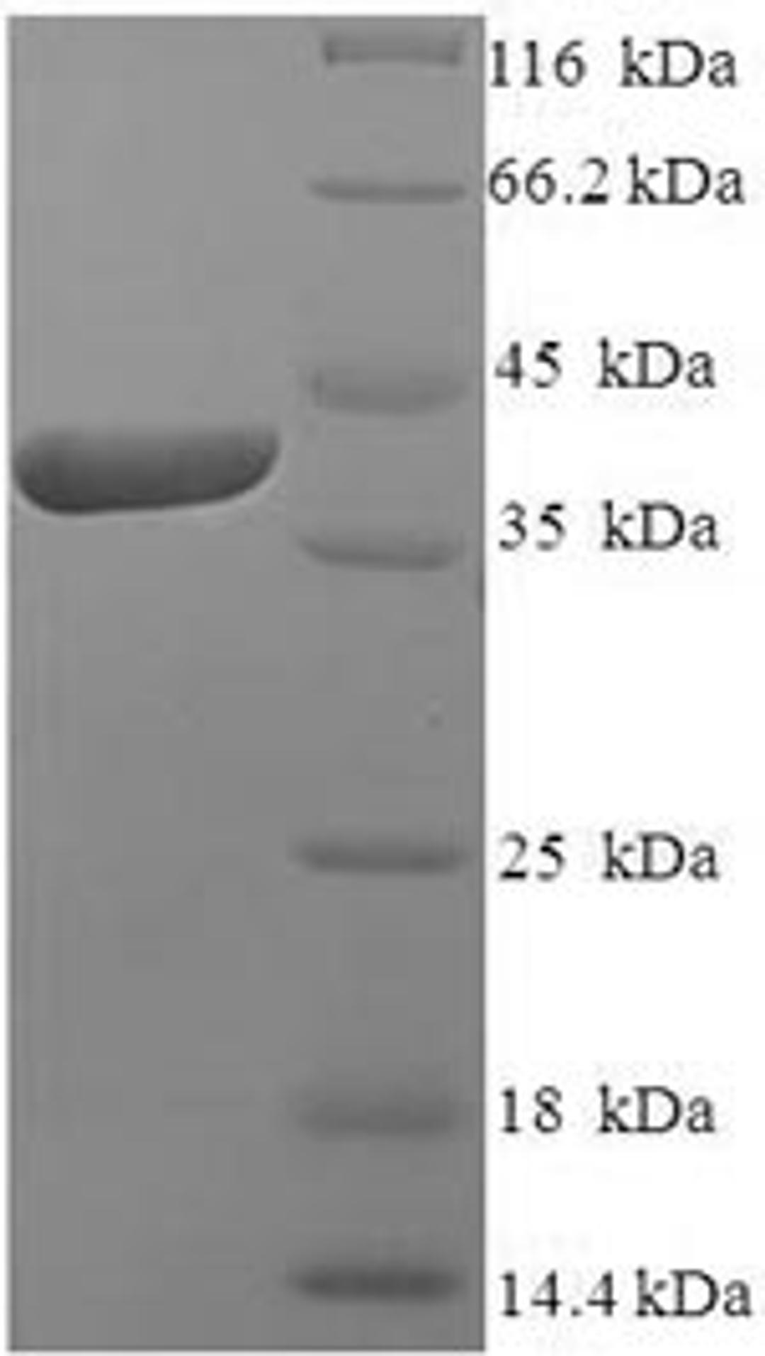 (Tris-Glycine gel) Discontinuous SDS-PAGE (reduced) with 5% enrichment gel and 15% separation gel.