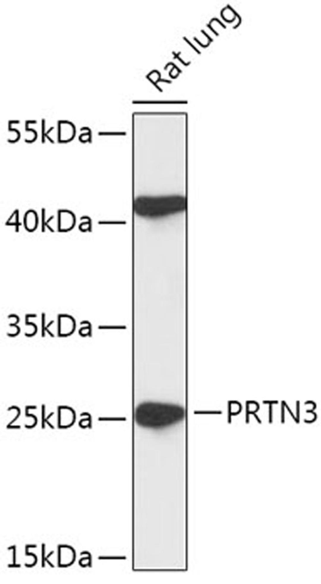 Western blot - PRTN3 antibody (A17522)