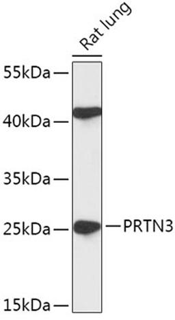 Western blot - PRTN3 antibody (A17522)