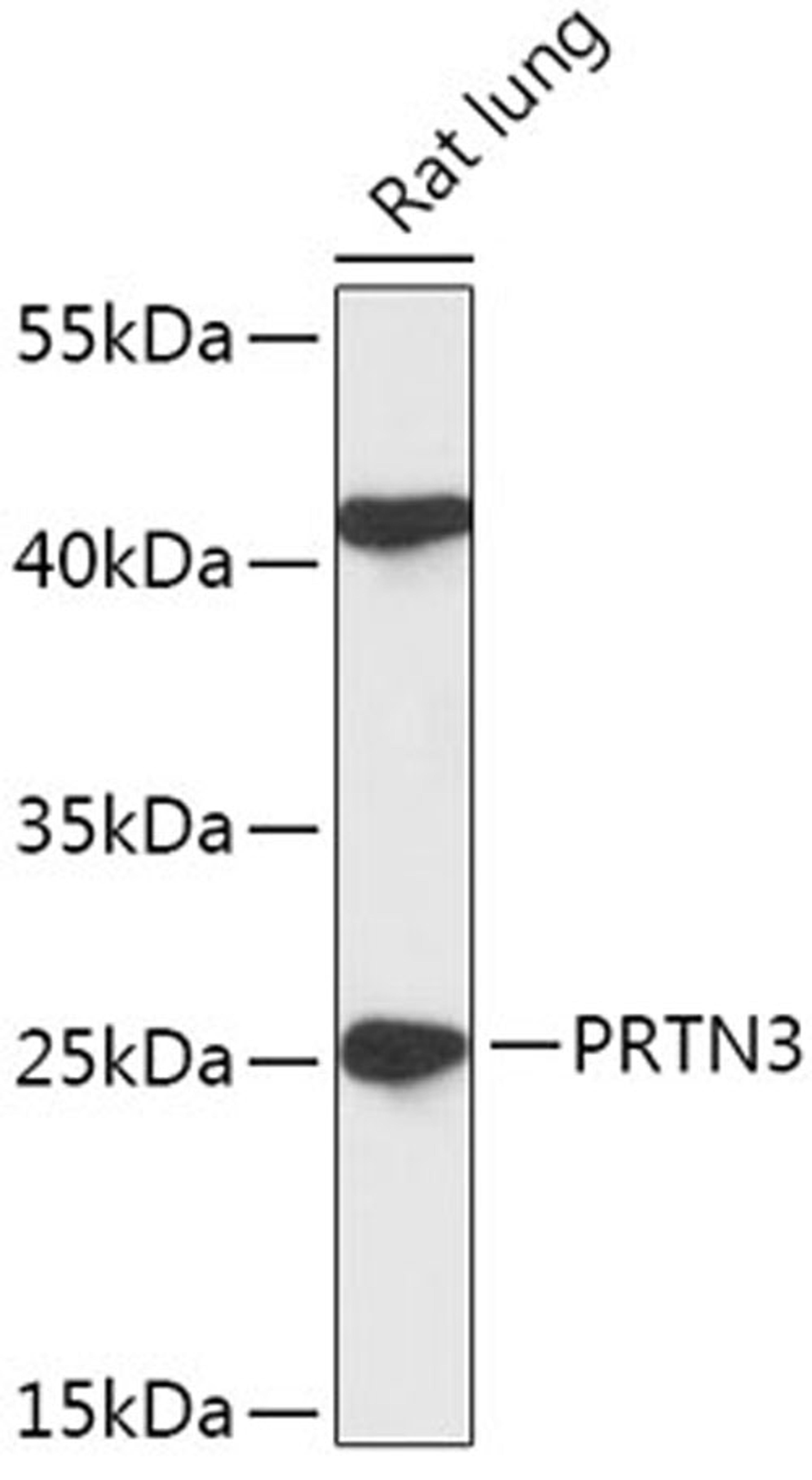 Western blot - PRTN3 antibody (A17522)