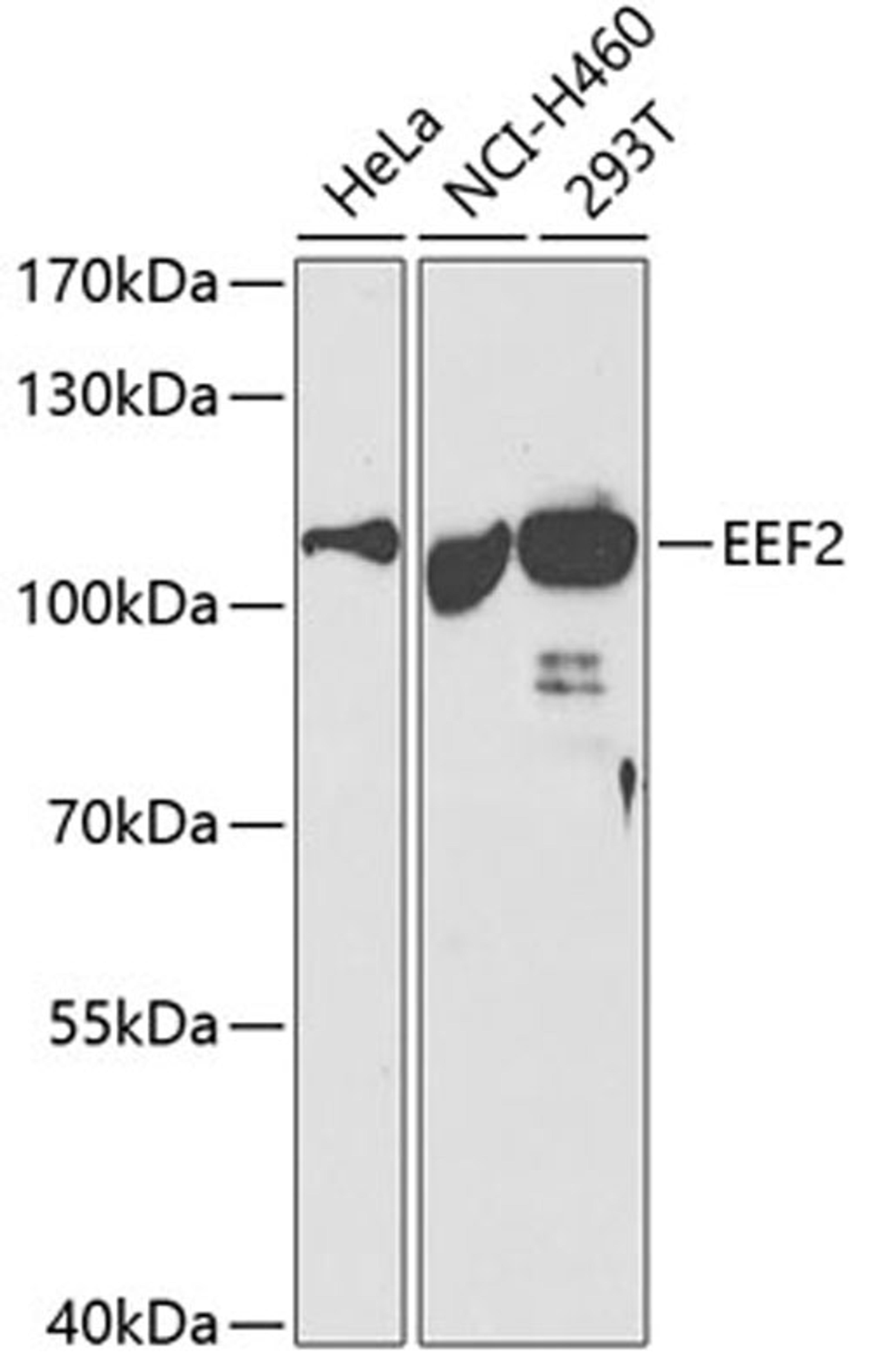 Western blot - EEF2 antibody (A2068)