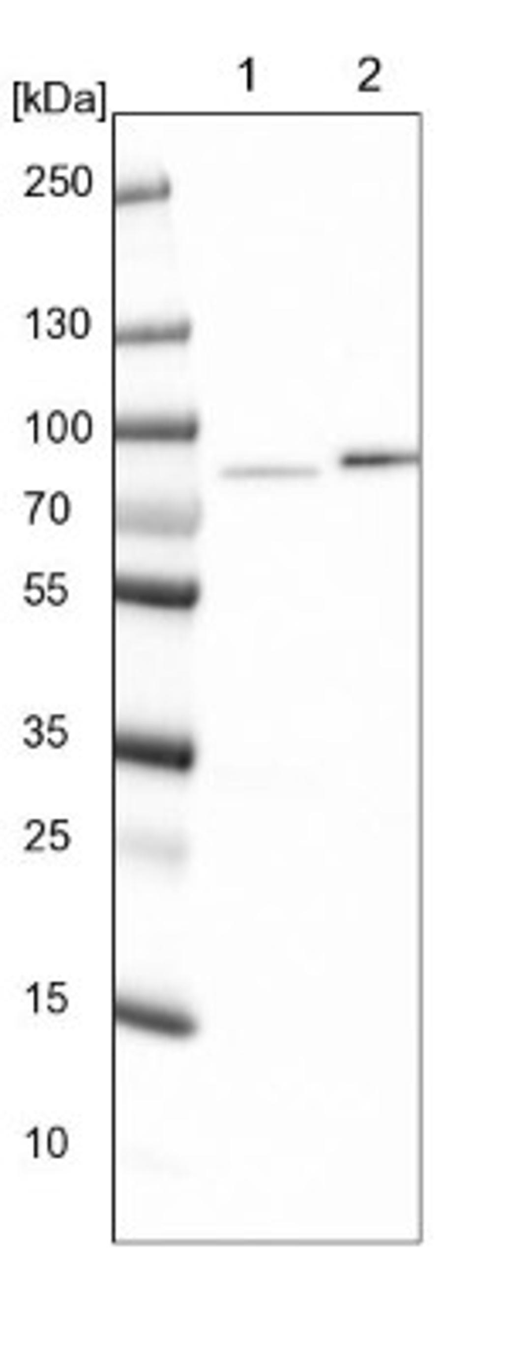 Western Blot: KLHDC4 Antibody [NBP1-85129] - Lane 1: NIH-3T3 cell lysate (Mouse embryonic fibroblast cells)<br/>Lane 2: NBT-II cell lysate (Rat Wistar bladder tumour cells)