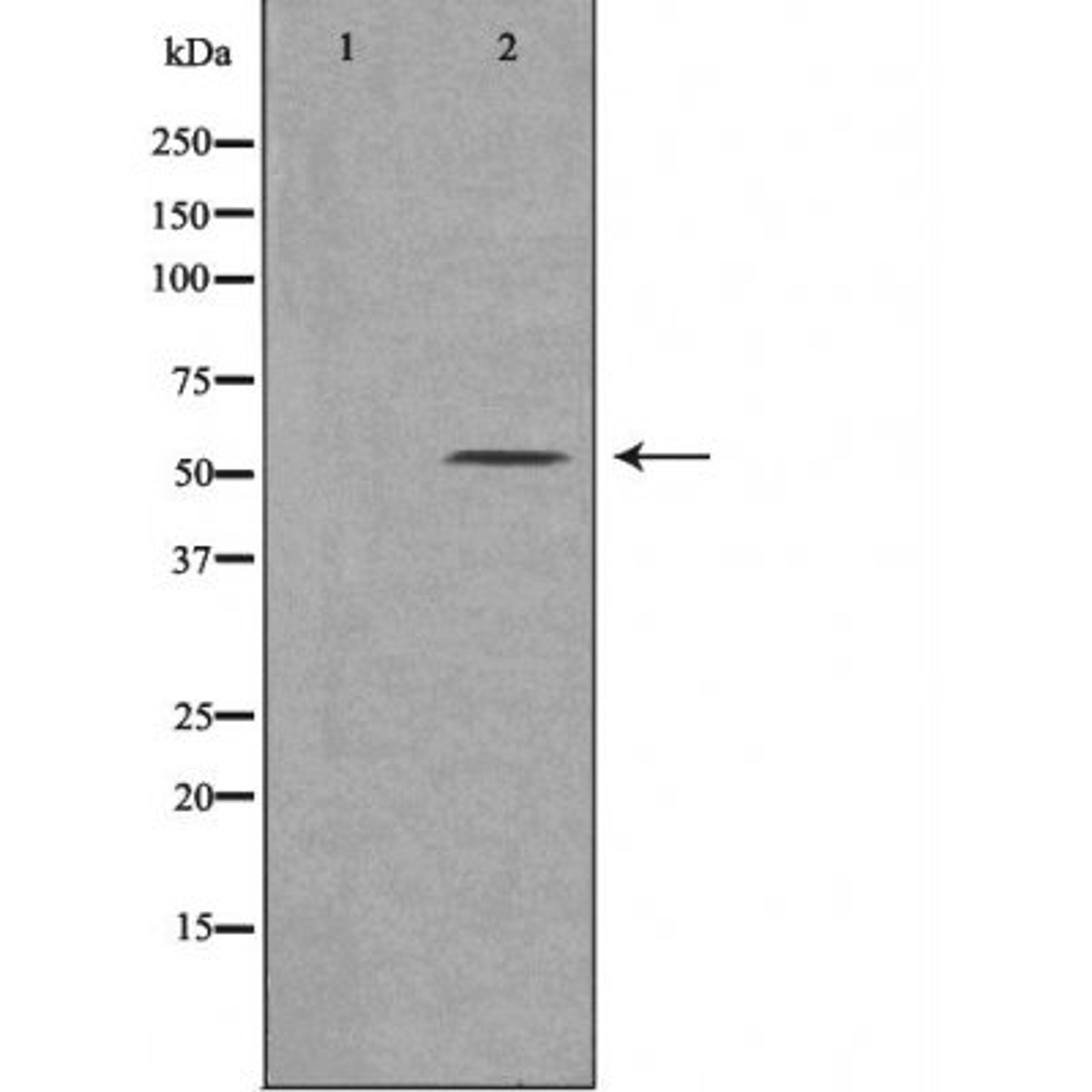 Western blot analysis of 293 cells using 21A2 (Cytochrome P450) antibody