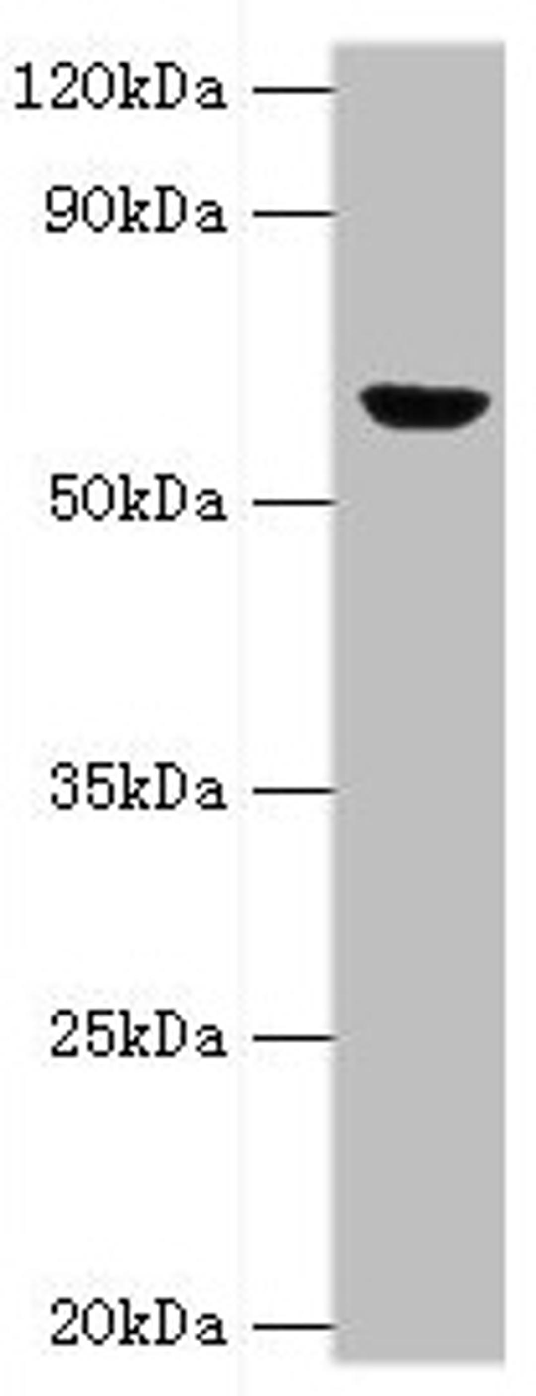 Western blot. All lanes: GLUD2 antibody at 2µg/ml + 293T whole cell lysate. Secondary. Goat polyclonal to rabbit IgG&nbsp;at 1/10000 dilution. Predicted band size: 61 kDa. Observed band size: 61 kDa