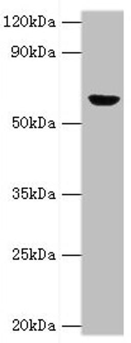 Western blot. All lanes: GLUD2 antibody at 2µg/ml + 293T whole cell lysate. Secondary. Goat polyclonal to rabbit IgG&nbsp;at 1/10000 dilution. Predicted band size: 61 kDa. Observed band size: 61 kDa