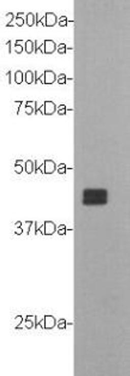 Western Blot analysis of recombinant protein of NETO1 using Neuropilin and tolloid-like protein 1 monoclonal antibody