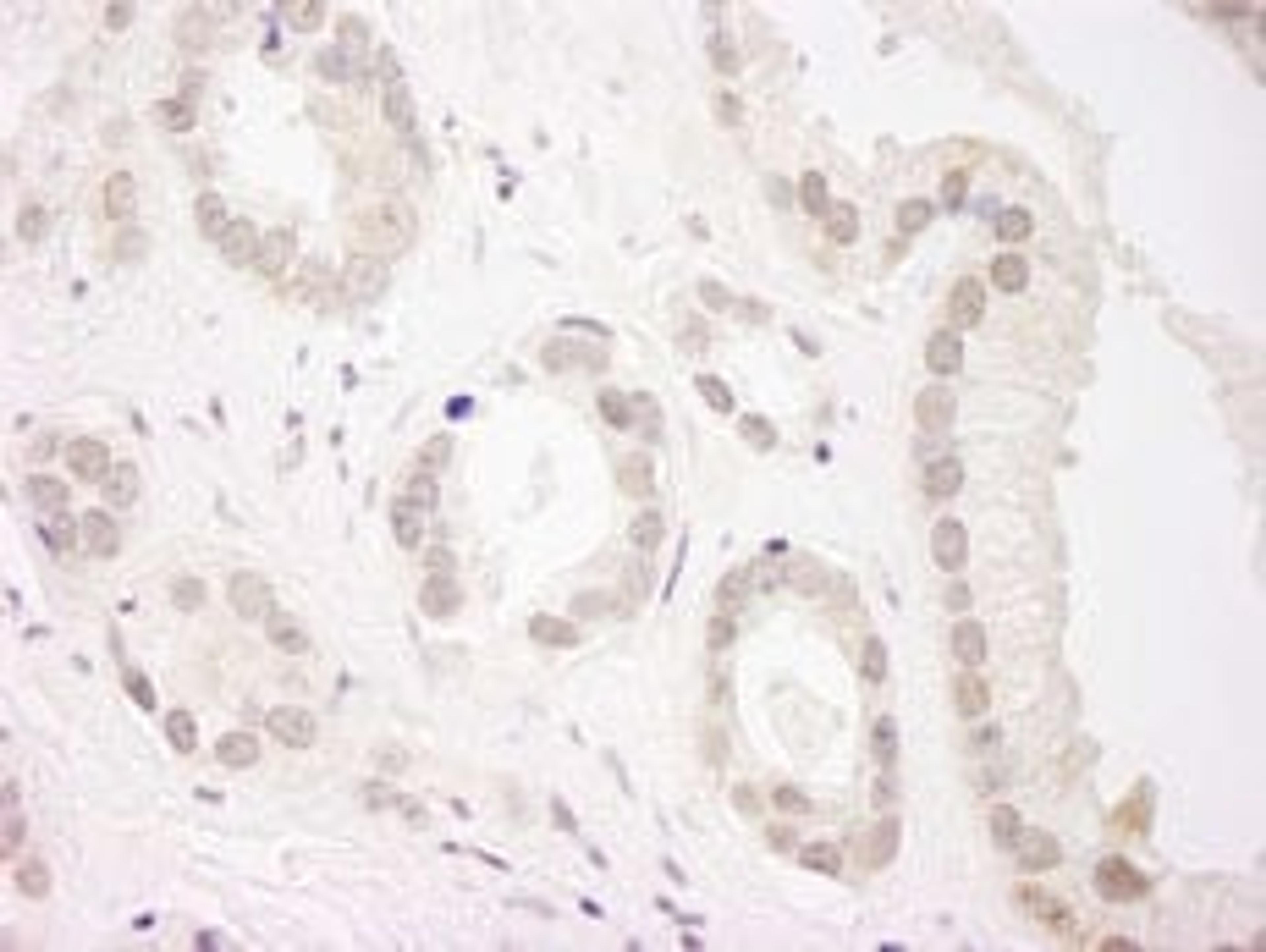 Detection of human USP34 by immunohistochemistry.