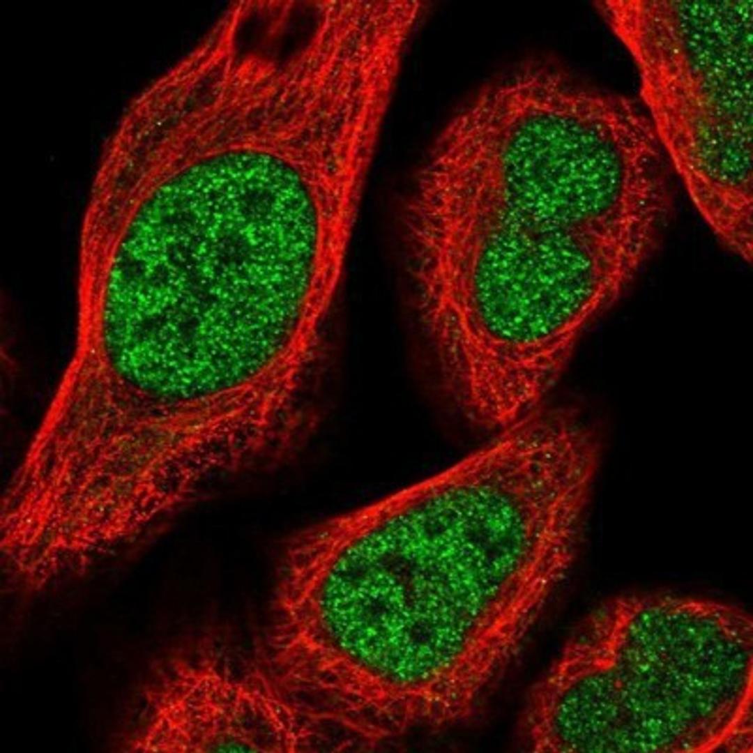 Immunocytochemistry/Immunofluorescence: HOXA3 Antibody [NBP1-83234] - Staining of human cell line U-2 OS shows positivity in nucleus but not nucleoli.