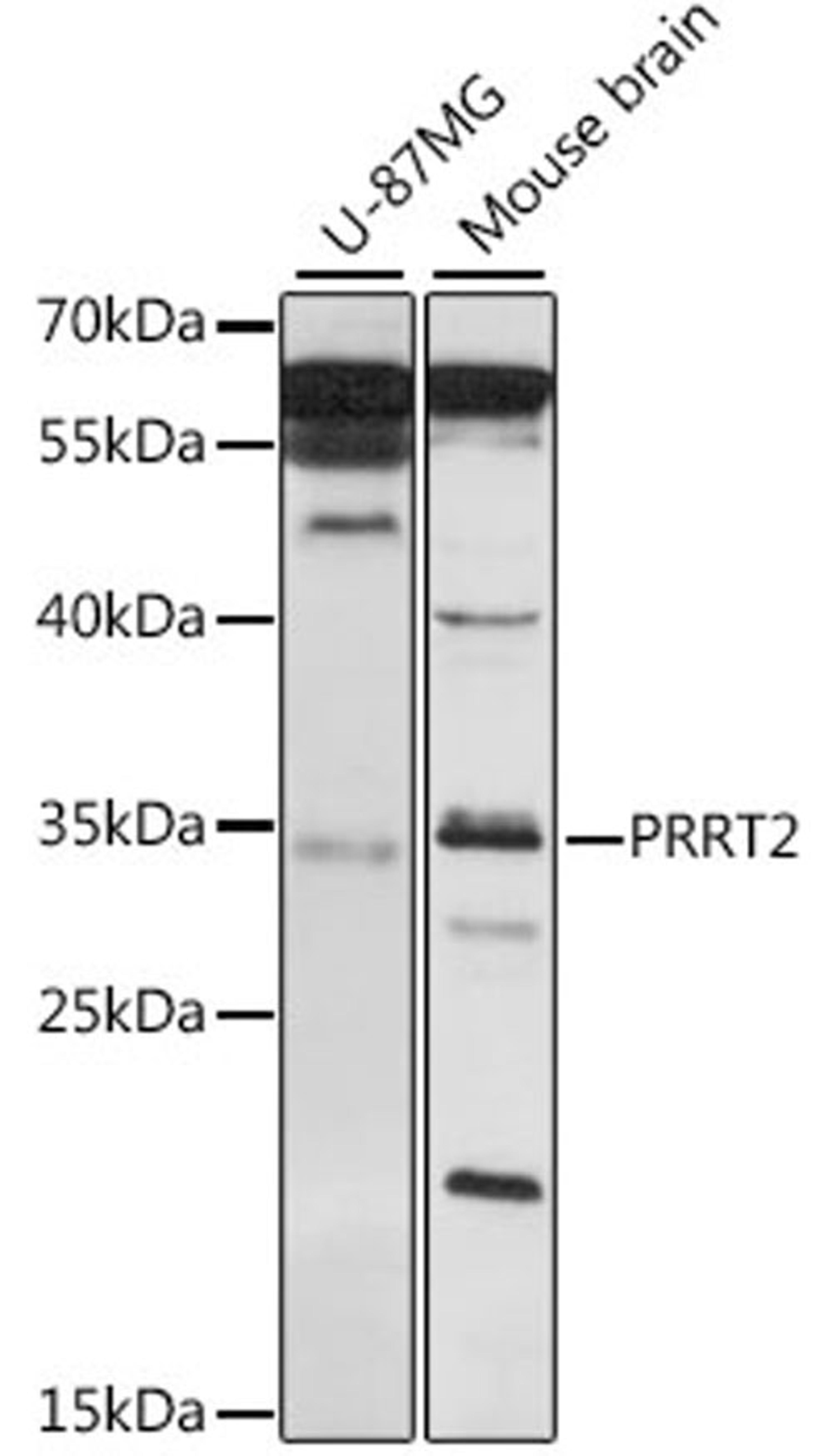 Western blot - PRRT2 antibody (A16027)