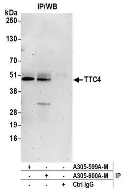 Detection of human TTC4 by WB of IP.