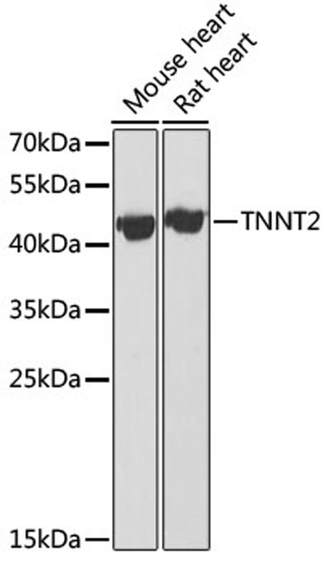 Western blot - TNNT2 antibody (A1126)