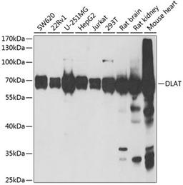 Western blot - DLAT antibody (A6288)