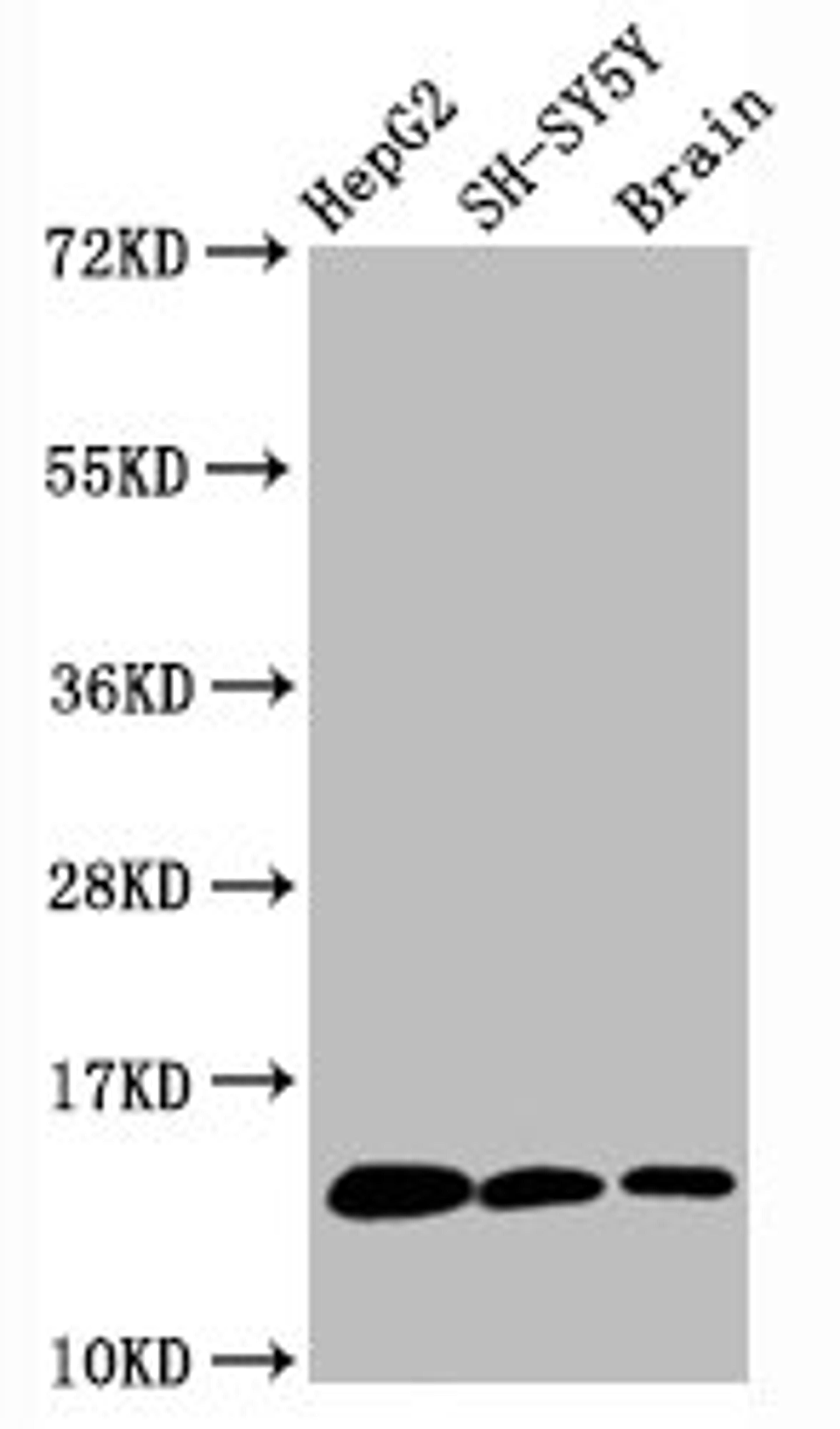 Western Blot. Positive WB detected in HepG2 whole cell lysate锛孲H-SY5Y whole cell lysate锛孯at brain tissue. All lanes Mono-methyl-Histone H3.1(K36)antibody at 0.6μg/ml. Secondary. Goat polyclonal to rabbit IgG at 1/50000 dilution. Predicted band size: 15 KDa. Observed band size: 15 KDa. 