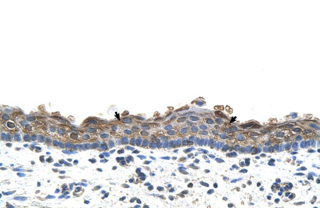 Antibody used in IHC on Human Skin.