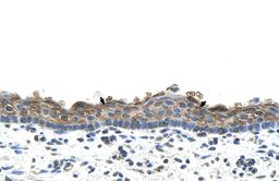 Antibody used in IHC on Human Skin.