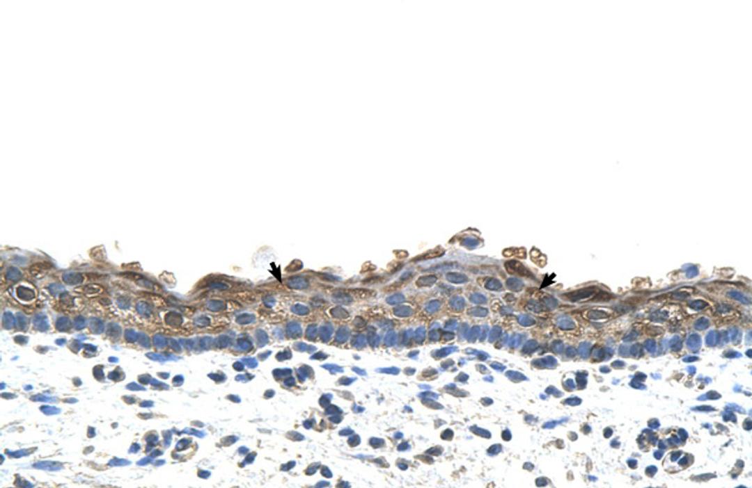 Antibody used in IHC on Human Skin.