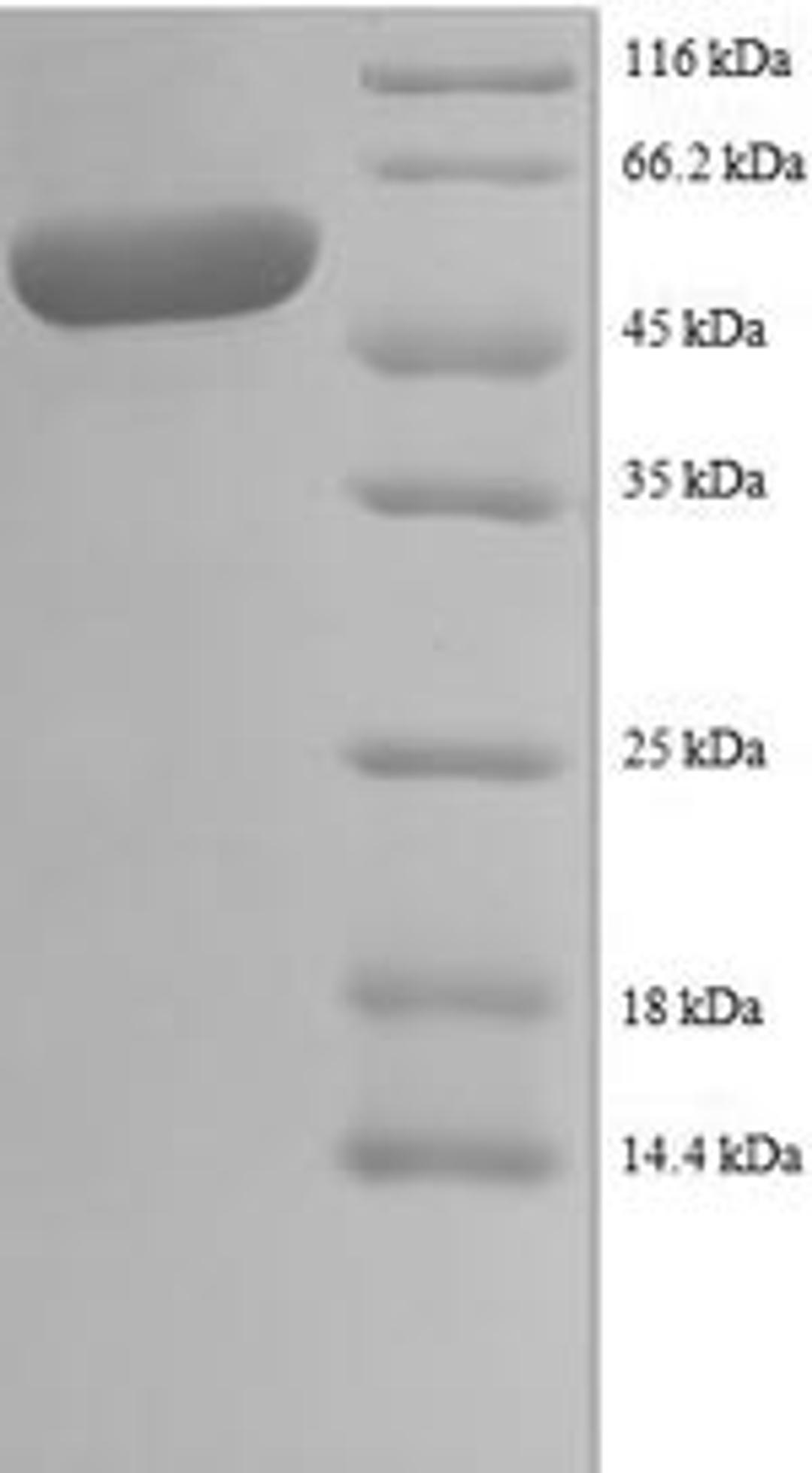 (Tris-Glycine gel) Discontinuous SDS-PAGE (reduced) with 5% enrichment gel and 15% separation gel.