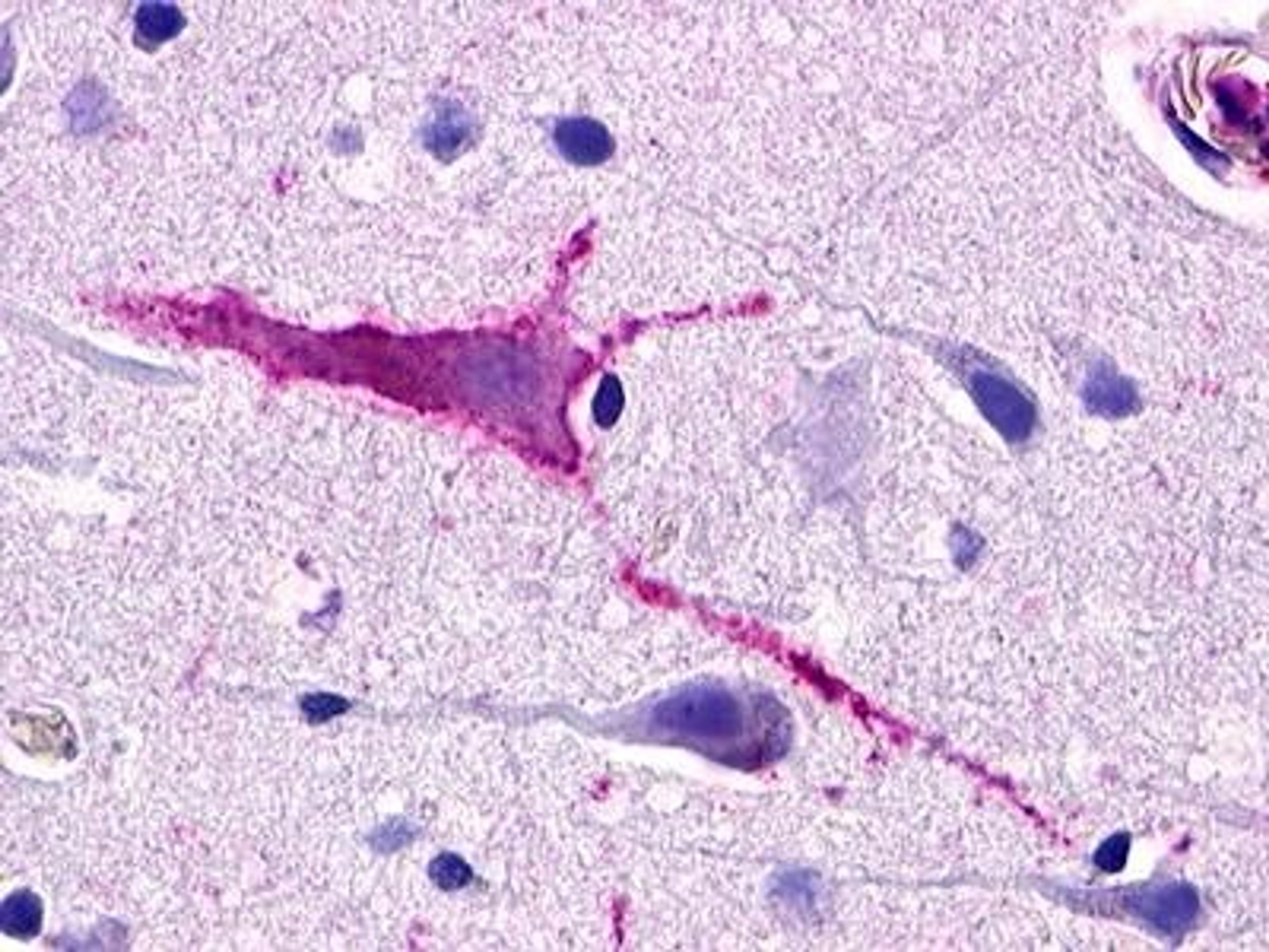 Immunohistochemistry-Paraffin: SREB3 Antibody [NLS527] - Analysis of anti-GPR173 antibody with brain, neuron.