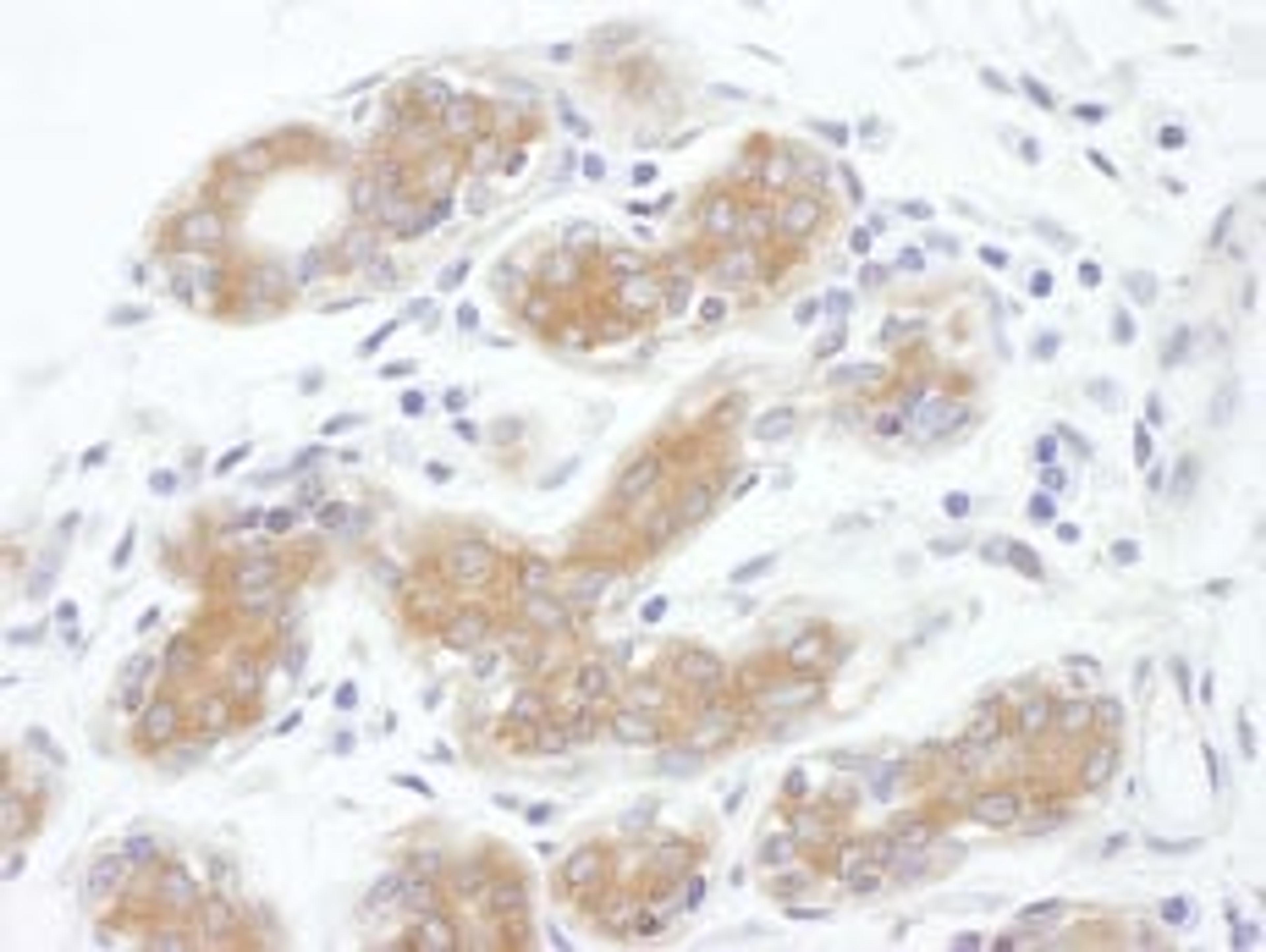 Detection of human ALIX by immunohistochemistry.