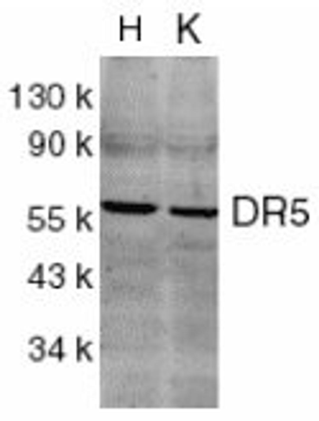 Western blot analysis of whole cell lysates from HeLa (H) and K562 (K) cells