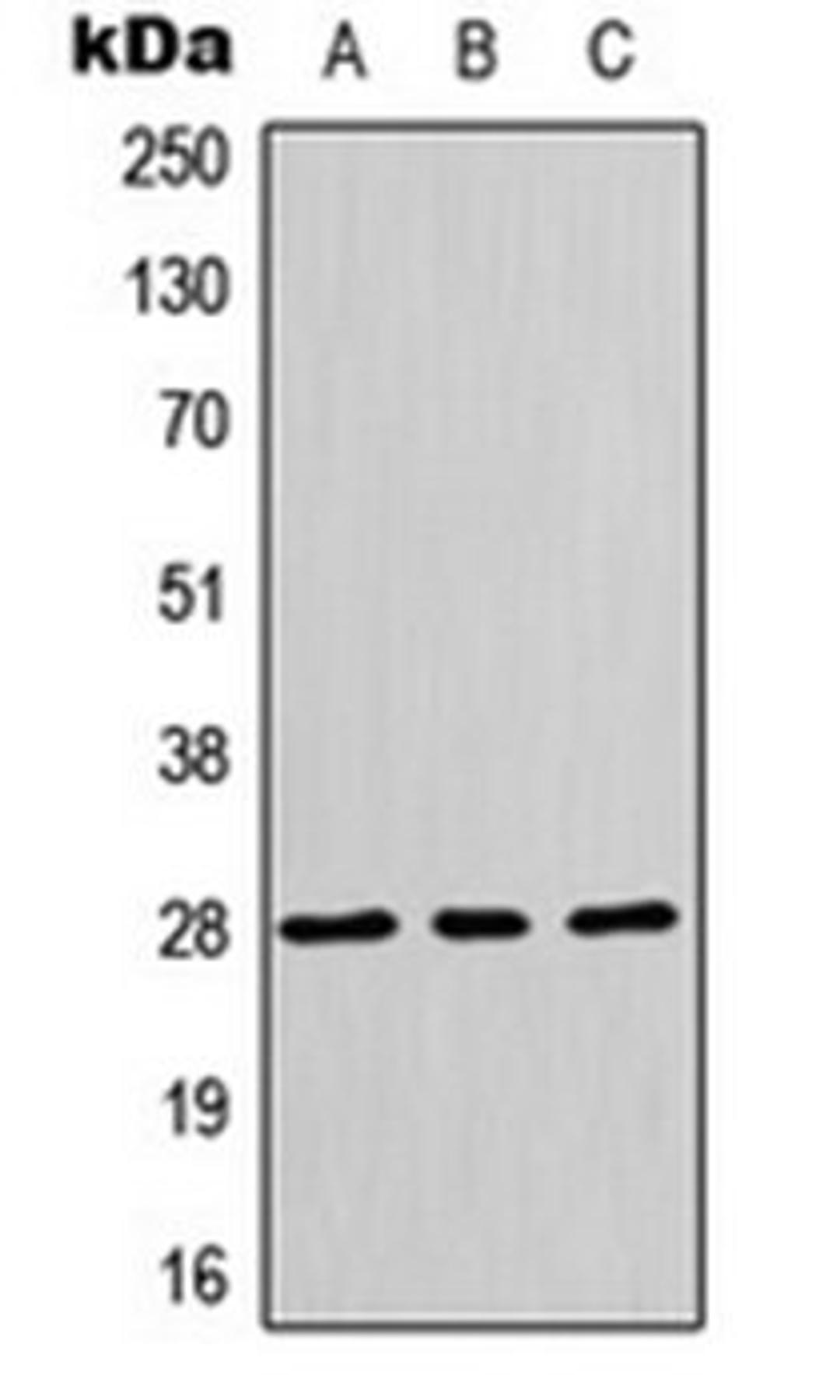 Western blot analysis of HepG2 (Lane 1), HeLa (Lane 2), MCF7 (Lane 3) whole cell lysates using HES6 antibody