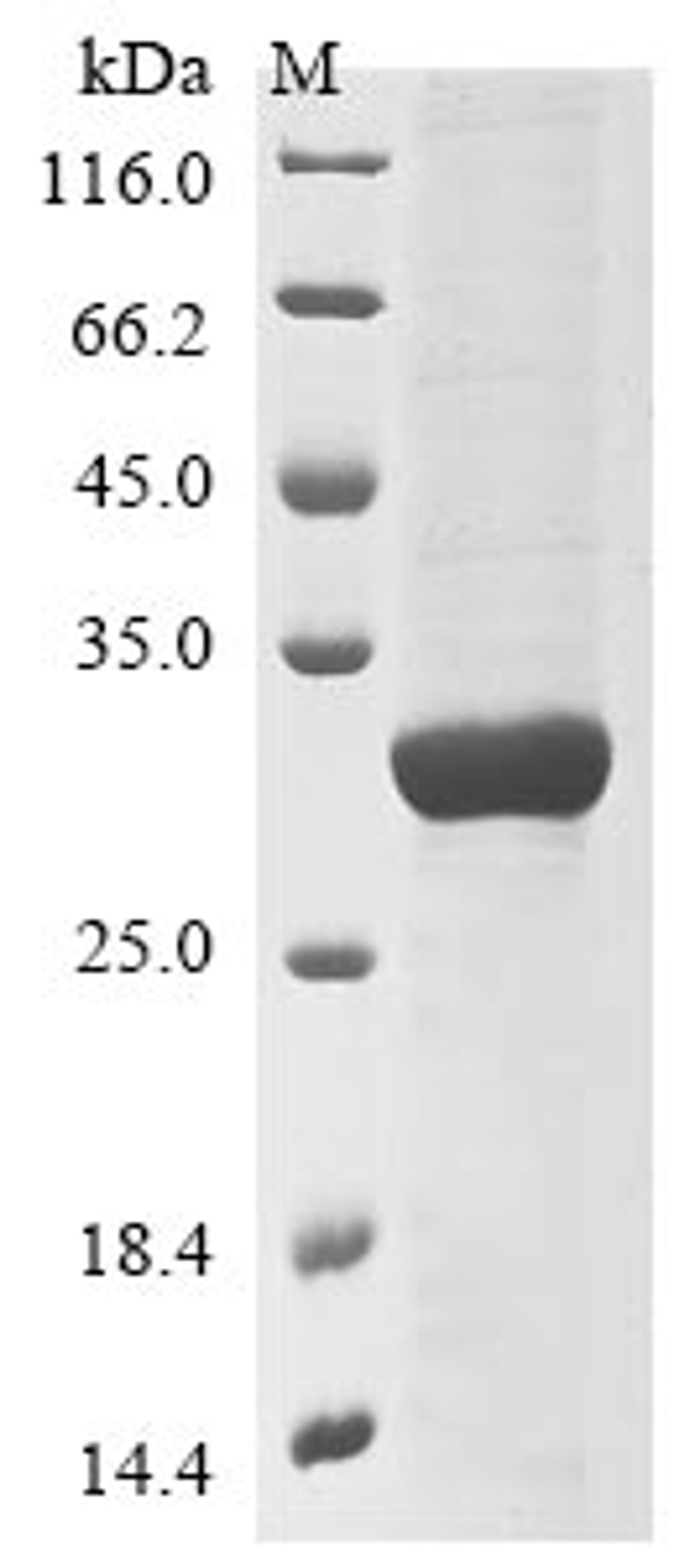 (Tris-Glycine gel) Discontinuous SDS-PAGE (reduced) with 5% enrichment gel and 15% separation gel.