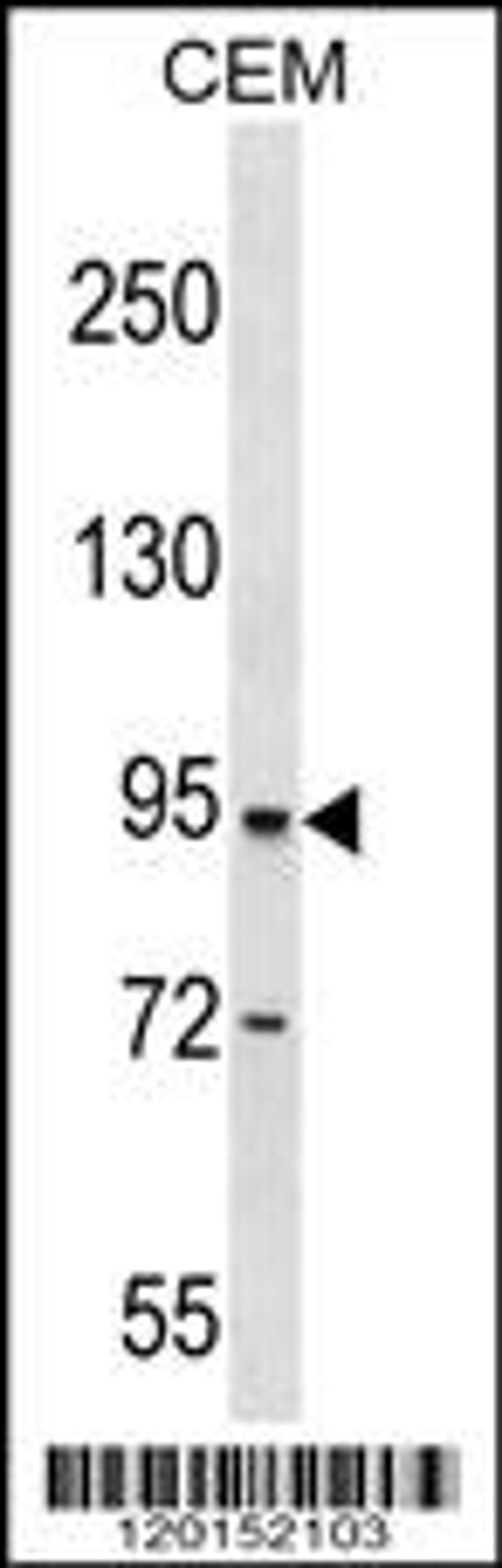 Western blot analysis in CEM cell line lysates (35ug/lane).