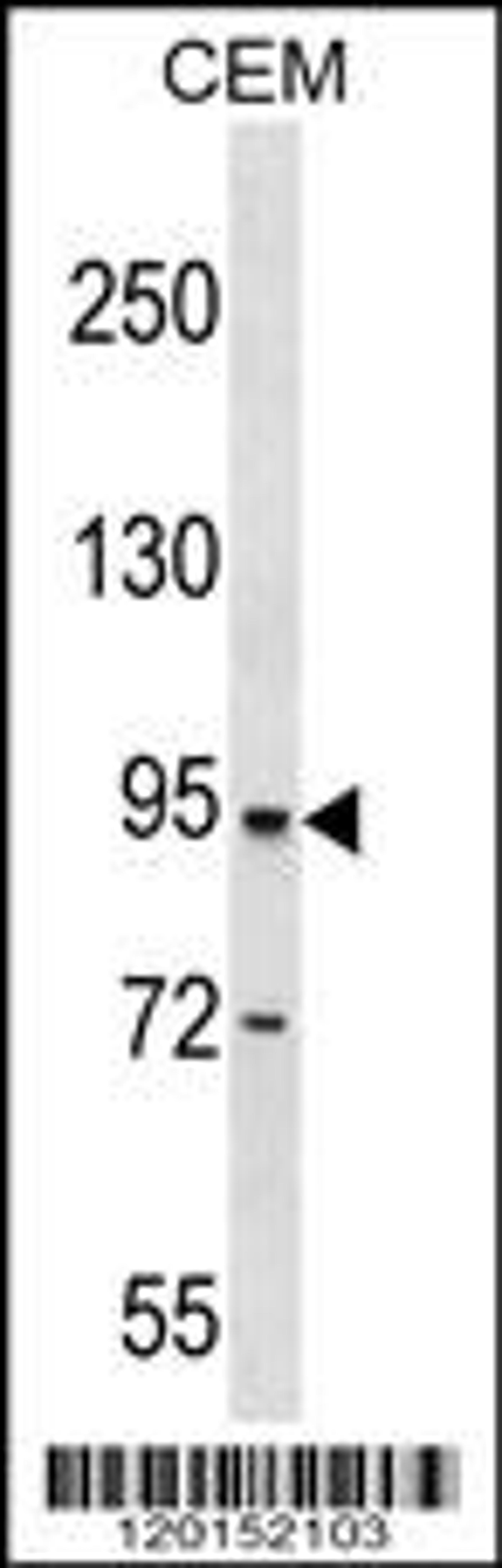 Western blot analysis in CEM cell line lysates (35ug/lane).