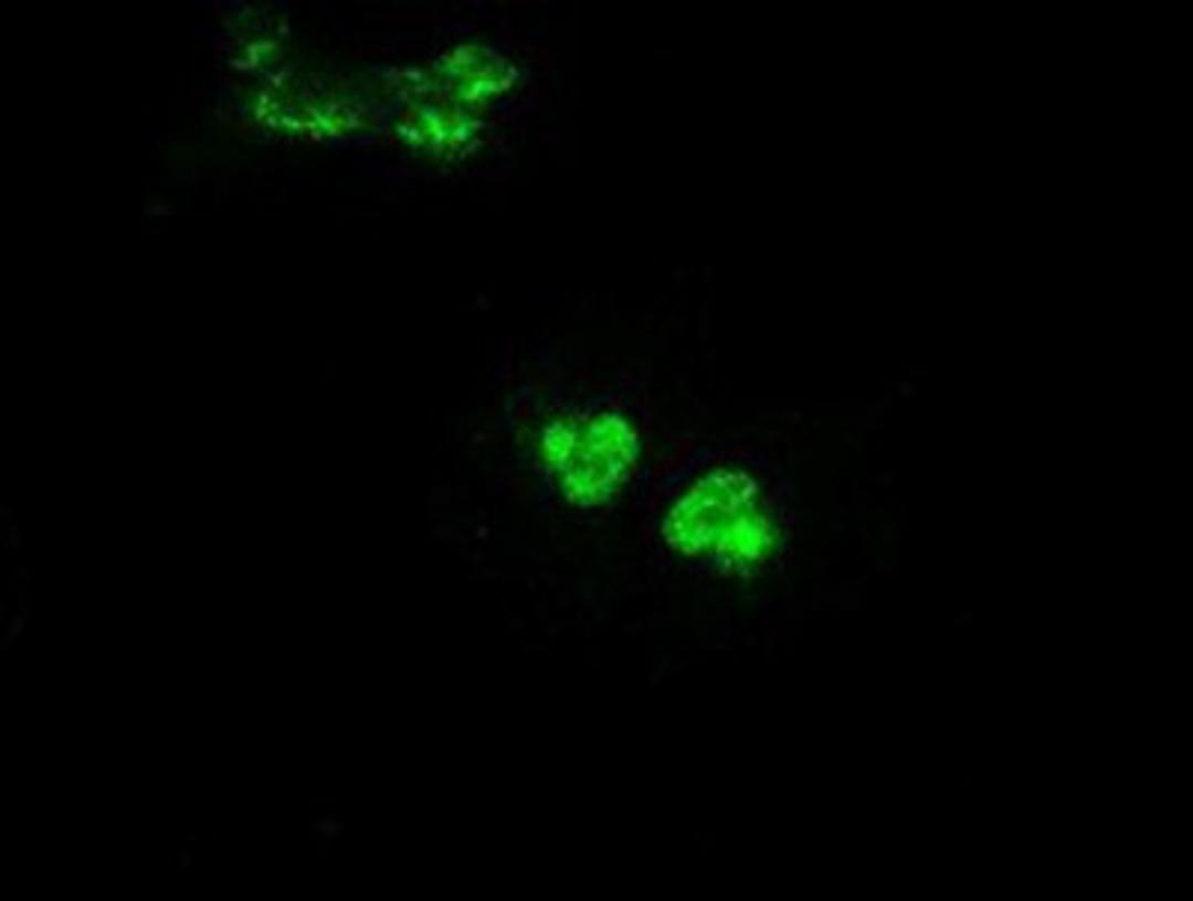 Immunocytochemistry/Immunofluorescence: GCK Antibody (3E3) [NBP1-47778] Staining of COS7 cells transiently transfected by pCMV6-ENTRY GCK.