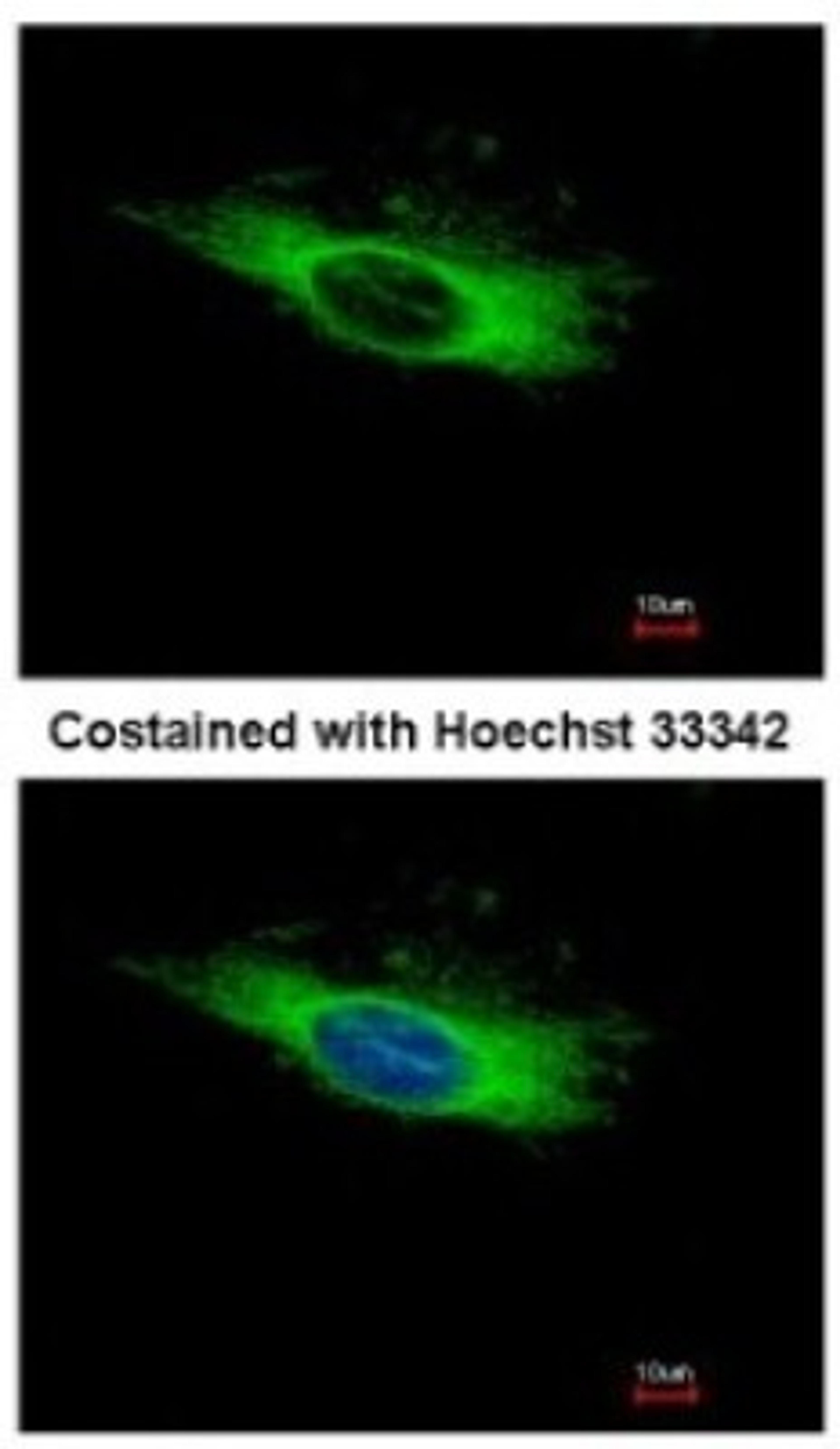 Immunocytochemistry/Immunofluorescence: AFM Antibody [NBP2-15304] - Analysis of methanol-fixed HeLa, using antibody at 1:500 dilution.