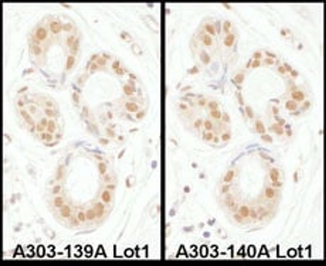 Detection of human SENP3 by immunohistochemistry.