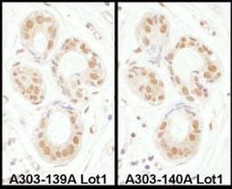 Detection of human SENP3 by immunohistochemistry.