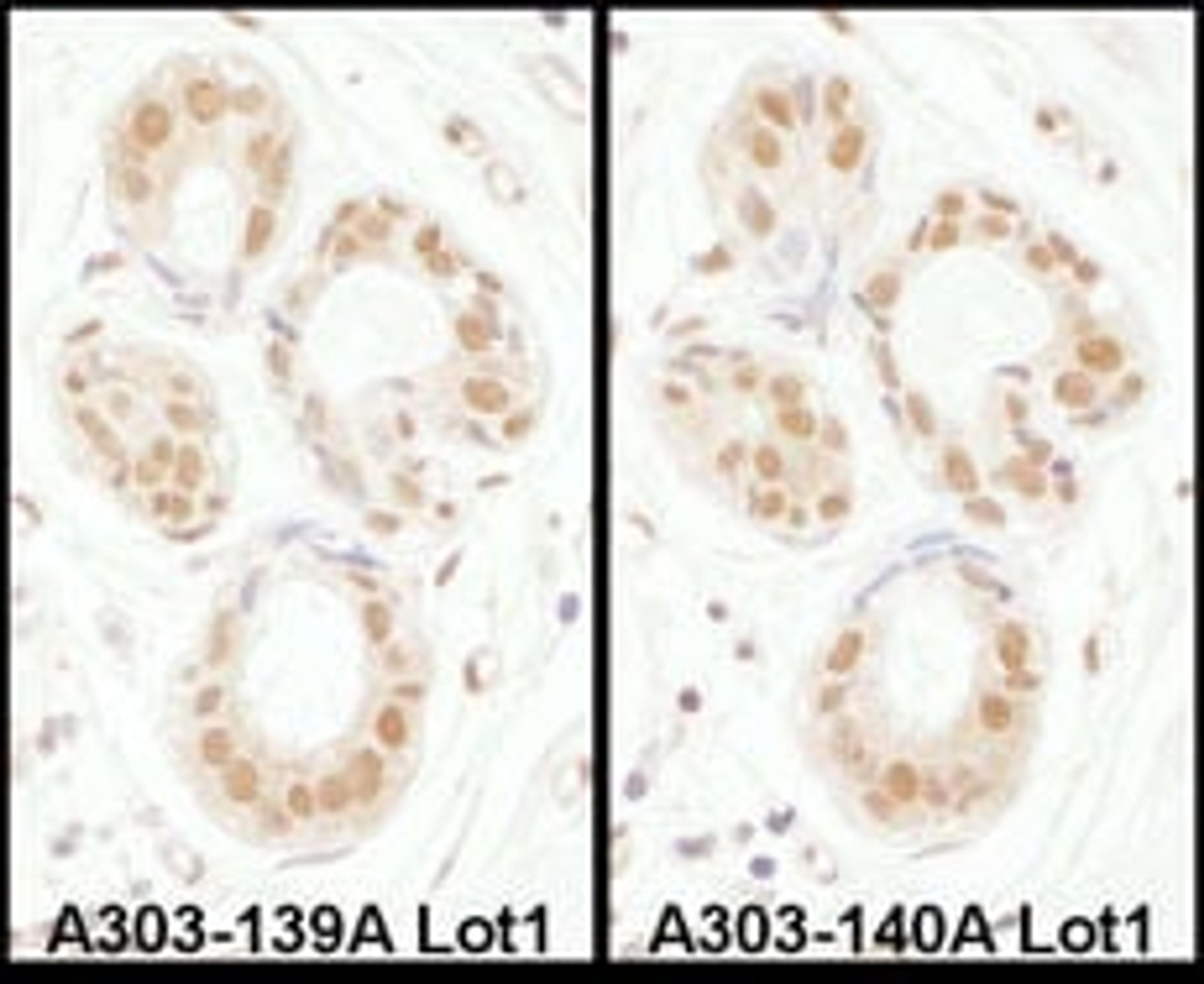 Detection of human SENP3 by immunohistochemistry.