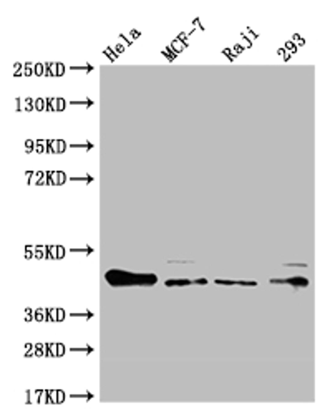 Western Blot. Positive WB detected in: Hela whole cell lysate, MCF-7 whole cell lysate, Raji whole cell lysate, HEK293 whole cell lysate. All lanes: ULBP1 antibody at 1:1000. Secondary. Goat polyclonal to rabbit IgG at 1/50000 dilution. Predicted band size: 28 kDa. Observed band size: 36-50 kDa. 