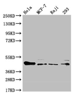 Western Blot. Positive WB detected in: Hela whole cell lysate, MCF-7 whole cell lysate, Raji whole cell lysate, HEK293 whole cell lysate. All lanes: ULBP1 antibody at 1:1000. Secondary. Goat polyclonal to rabbit IgG at 1/50000 dilution. Predicted band size: 28 kDa. Observed band size: 36-50 kDa. 