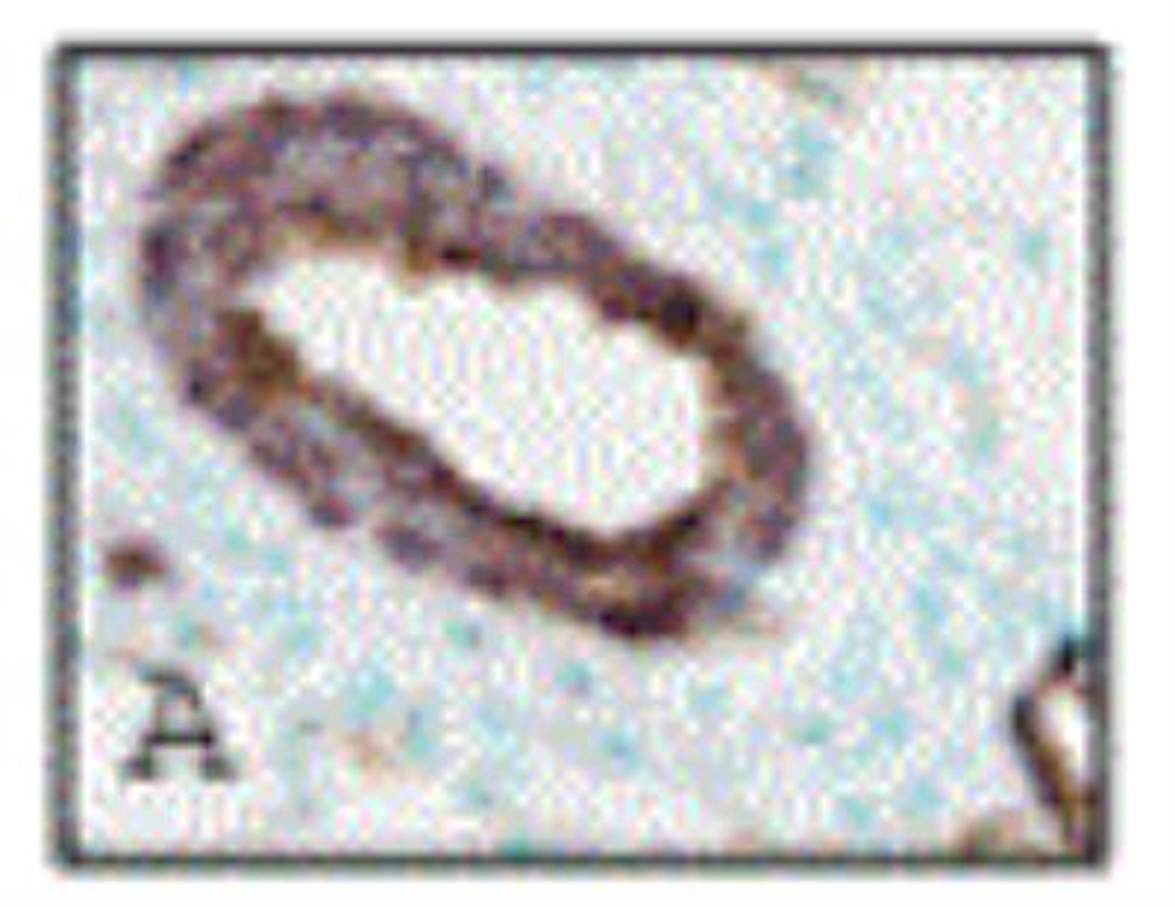 Immunohistochemistry-Paraffin: PDE1C Antibody [NB300-672] - IHC of artery walls with antibody