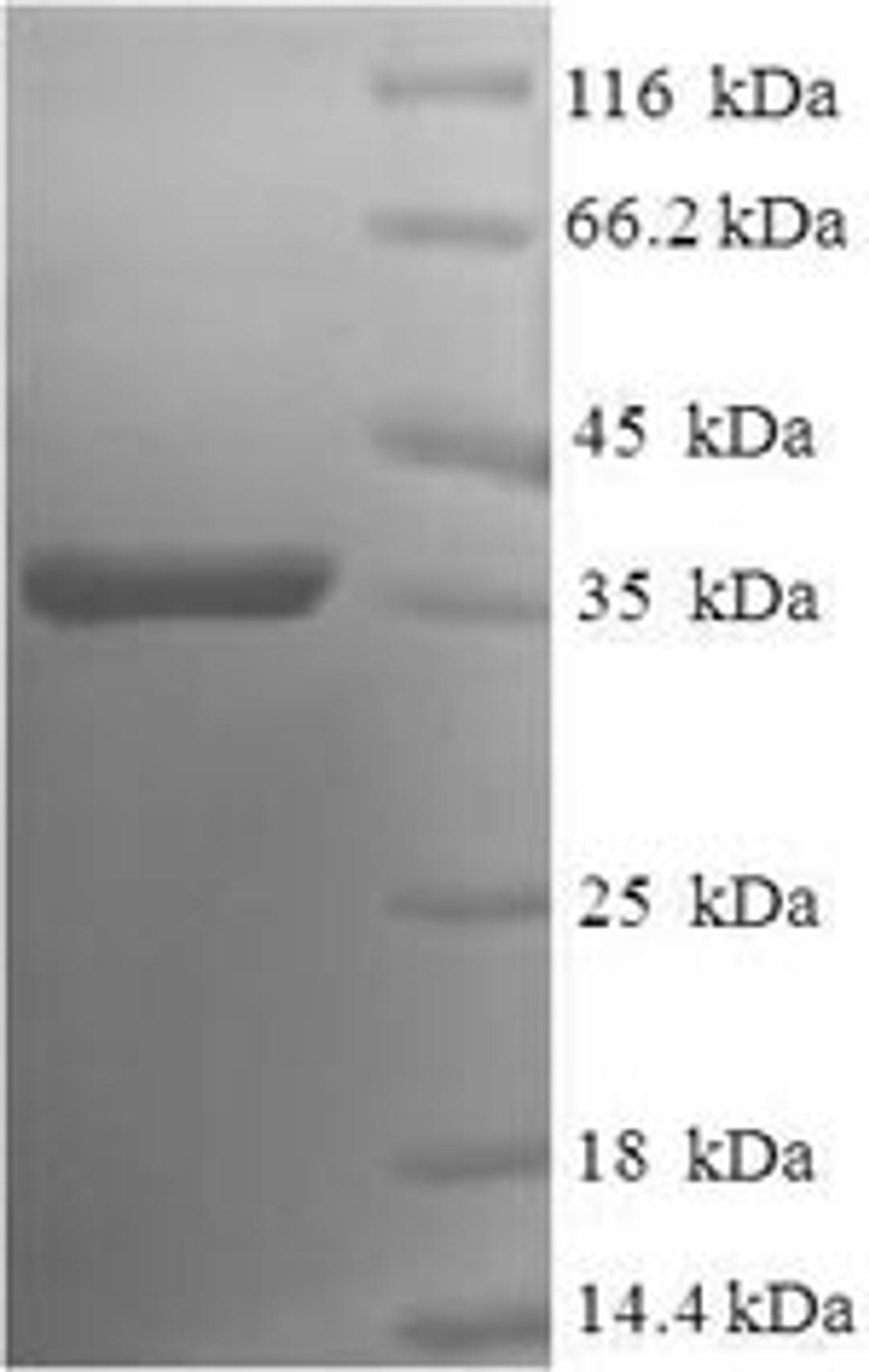 (Tris-Glycine gel) Discontinuous SDS-PAGE (reduced) with 5% enrichment gel and 15% separation gel.