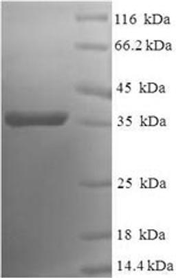 (Tris-Glycine gel) Discontinuous SDS-PAGE (reduced) with 5% enrichment gel and 15% separation gel.