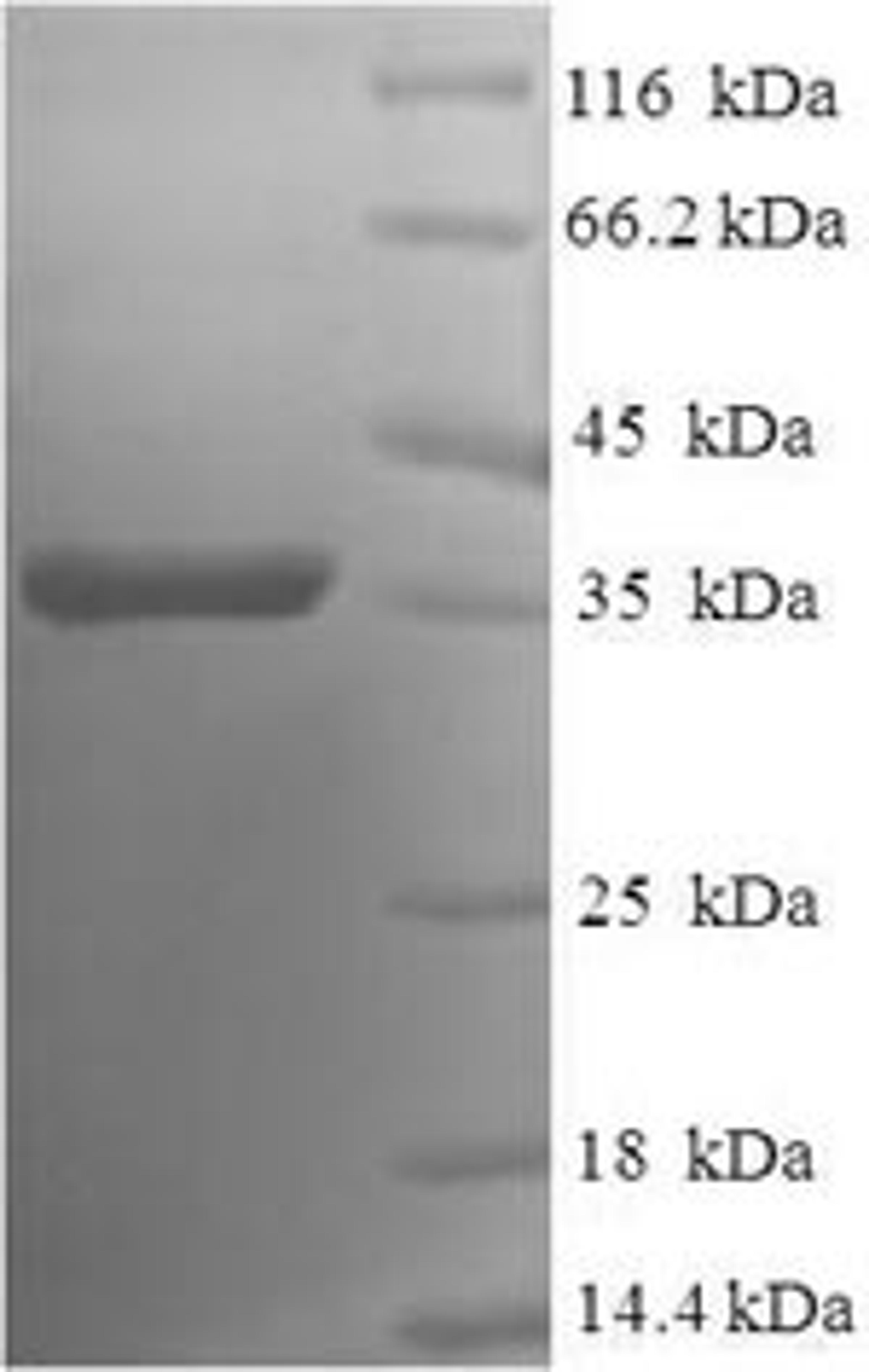 (Tris-Glycine gel) Discontinuous SDS-PAGE (reduced) with 5% enrichment gel and 15% separation gel.