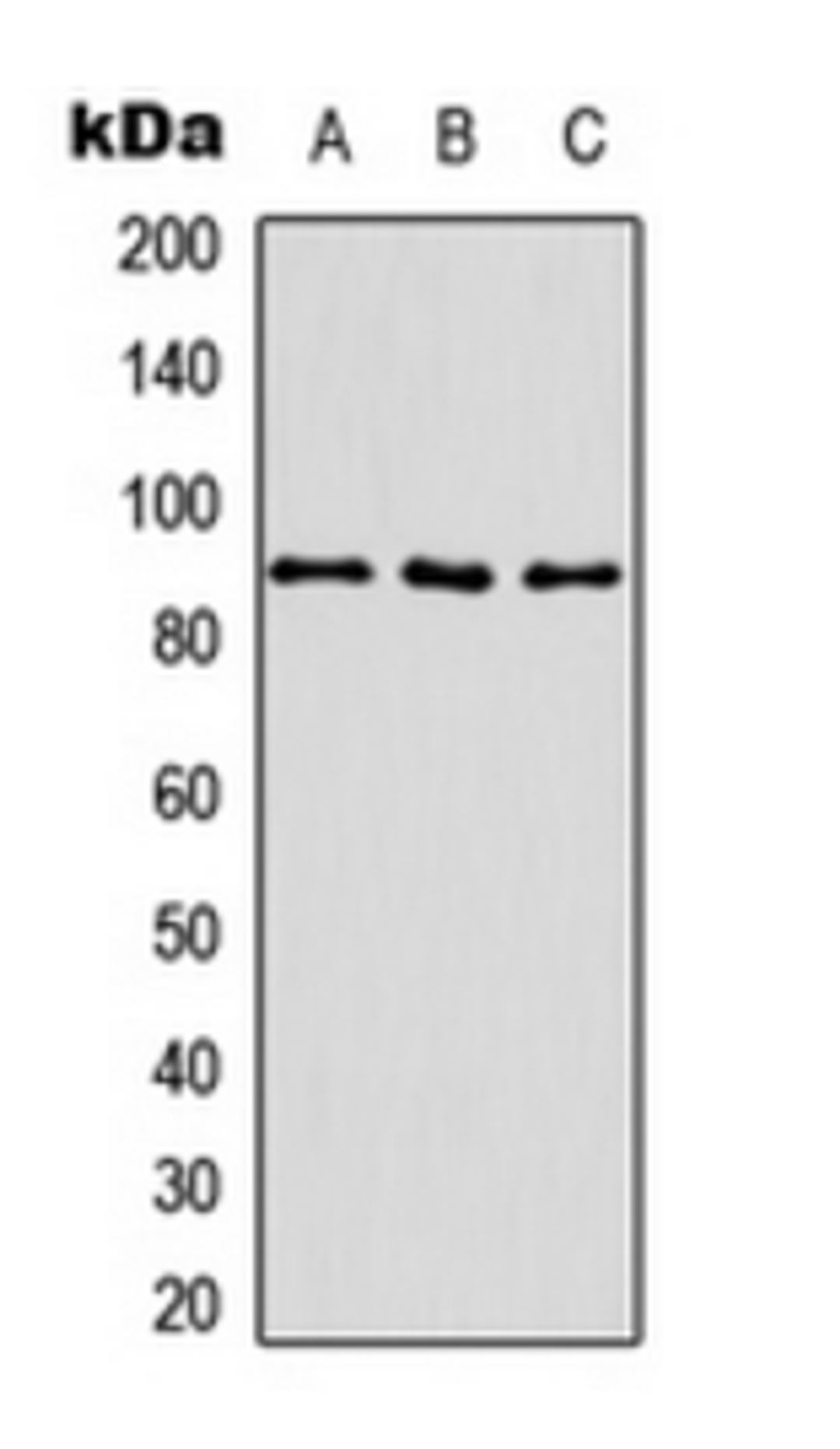 Western blot analysis of HEK293T (Lane 1), mouse kidney (Lane 2), rat liver (Lane 3) whole cell lysates using ITGB1 (Phospho-T789) antibody