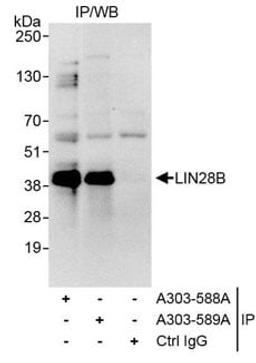 Detection of human LIN28B by western blot of immunoprecipitates.