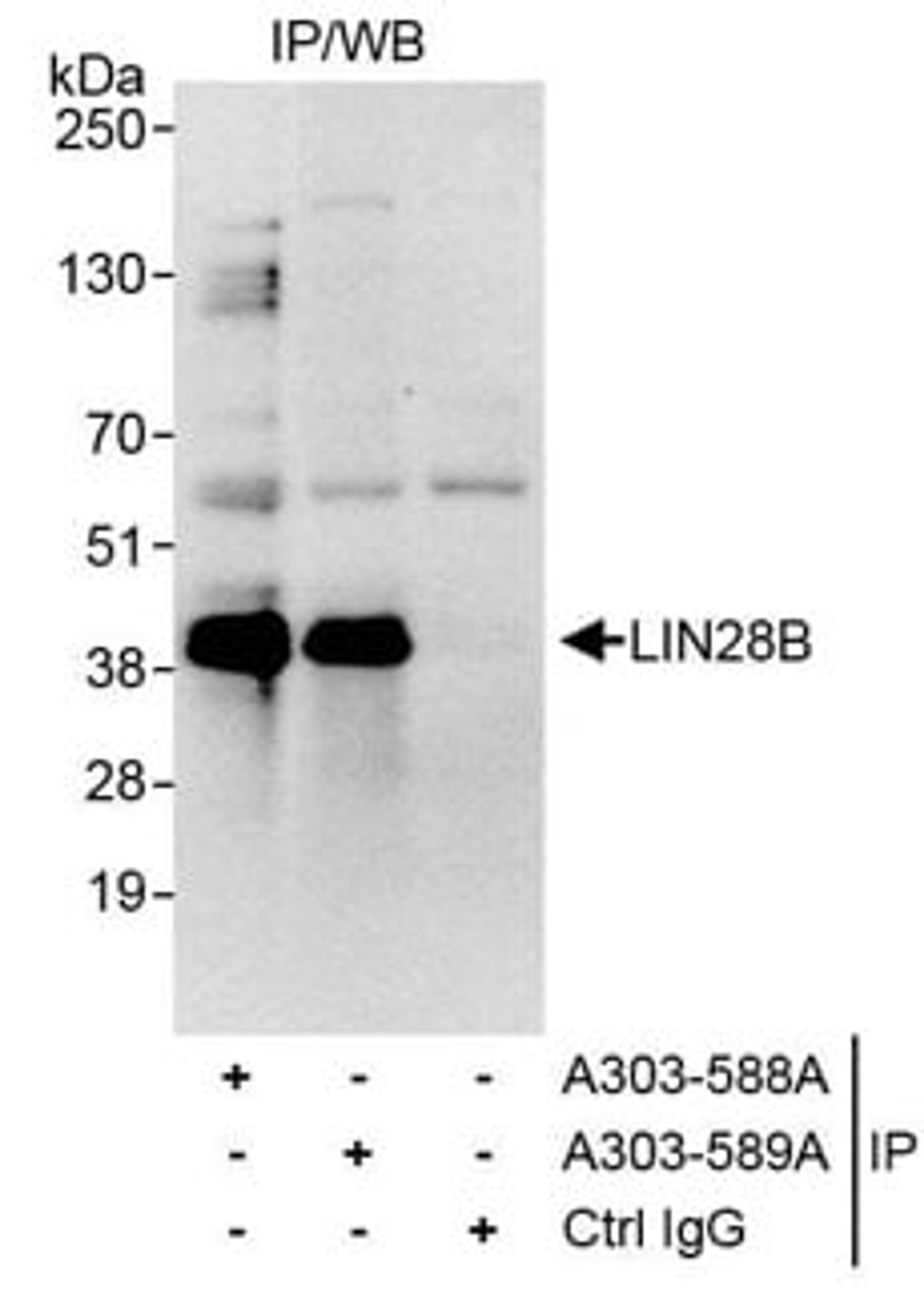 Detection of human LIN28B by western blot of immunoprecipitates.