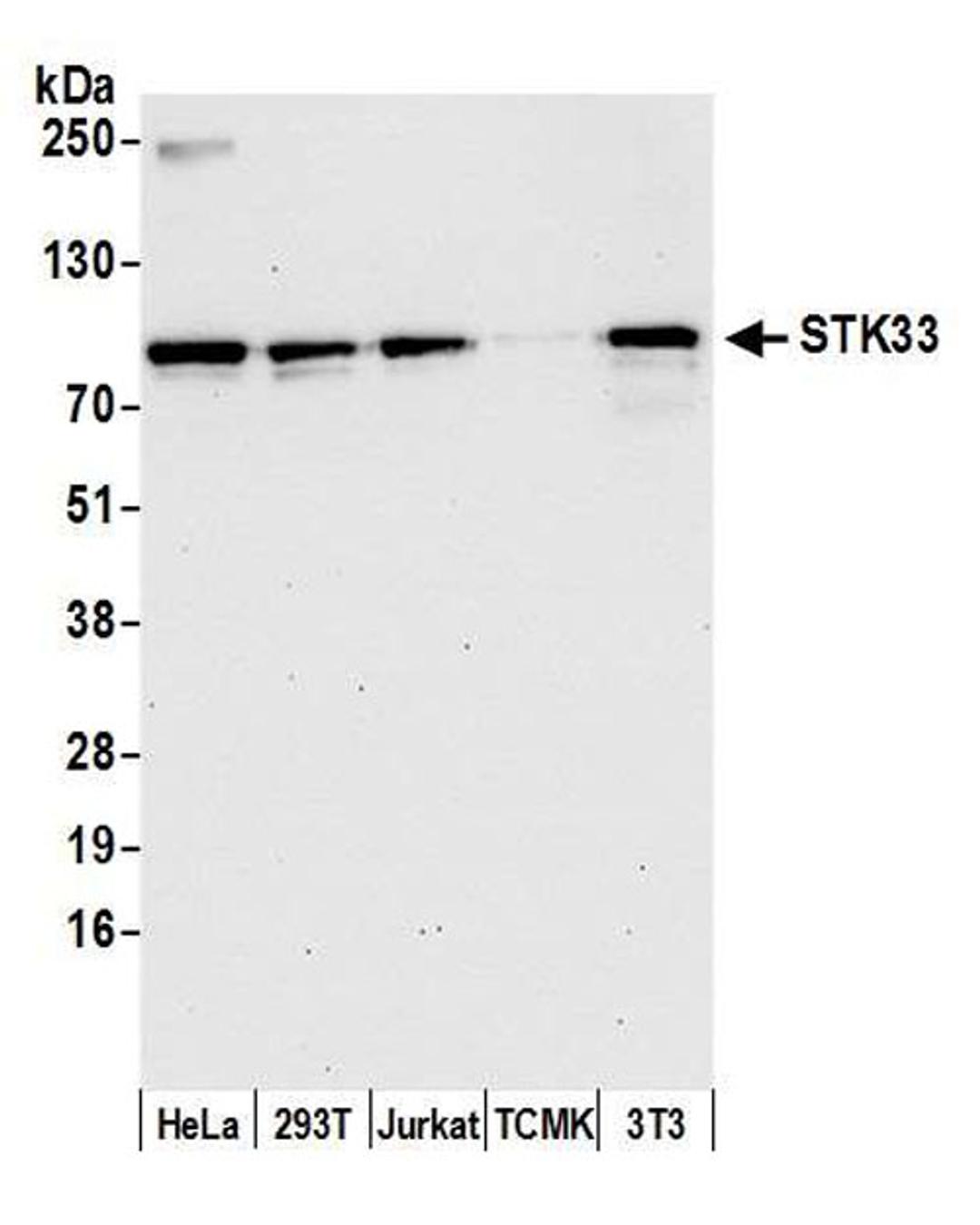 Detection of human and mouse STK33 by WB.