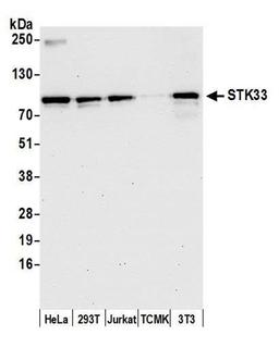 Detection of human and mouse STK33 by WB.